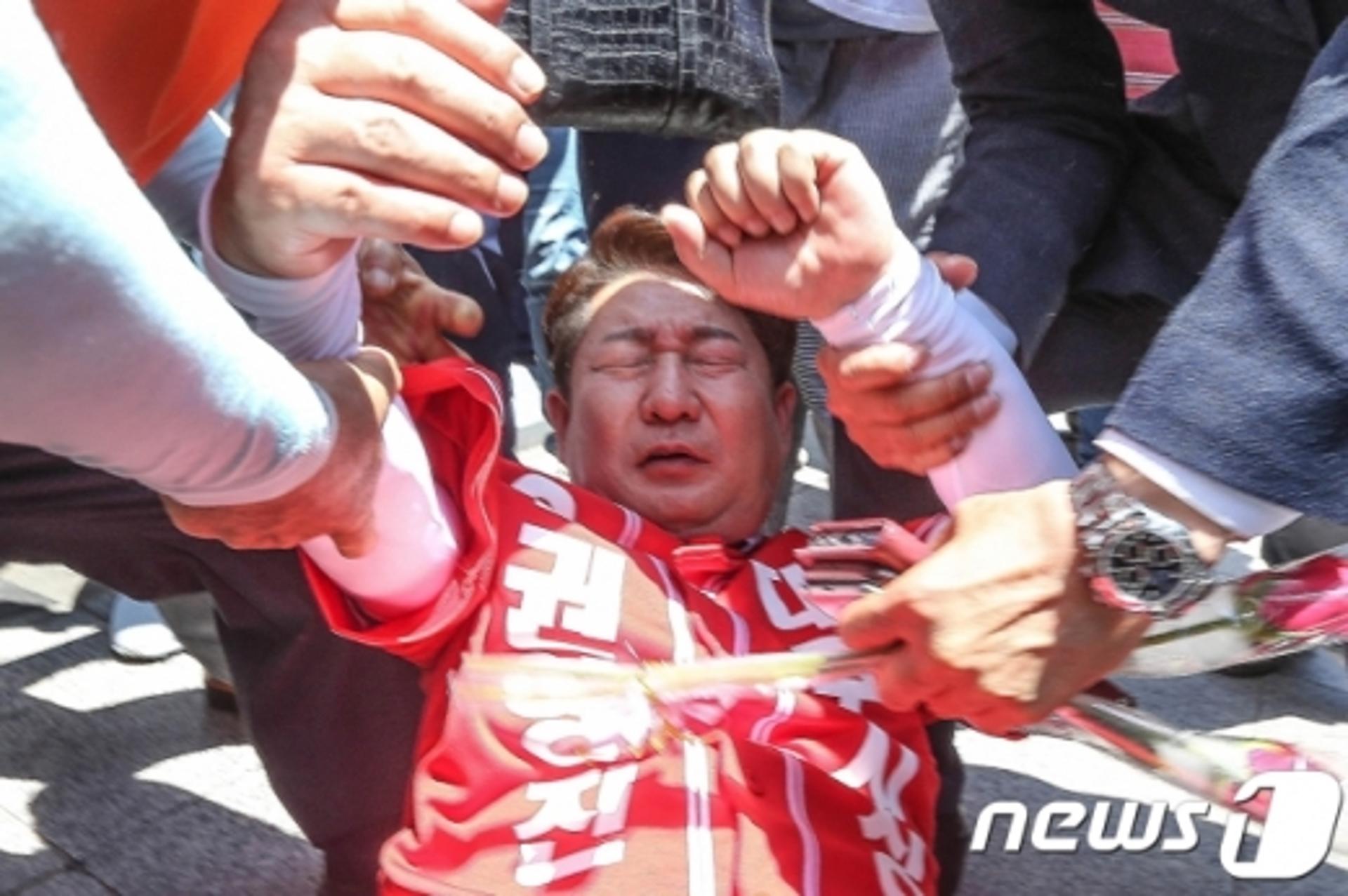 권영진 "선거테러 발표 과해, 가해자 처벌 원치 않아"