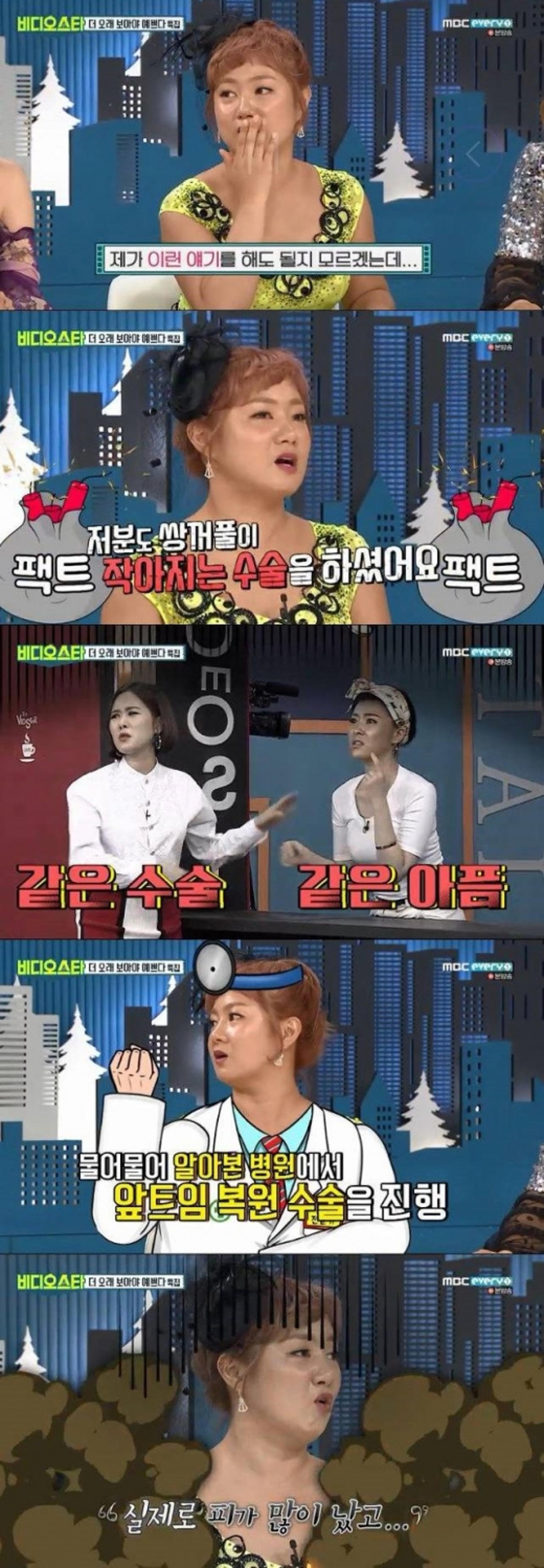 '비스' 박나래 앞트임 복원 고백 "실제로 피도 많이 나"