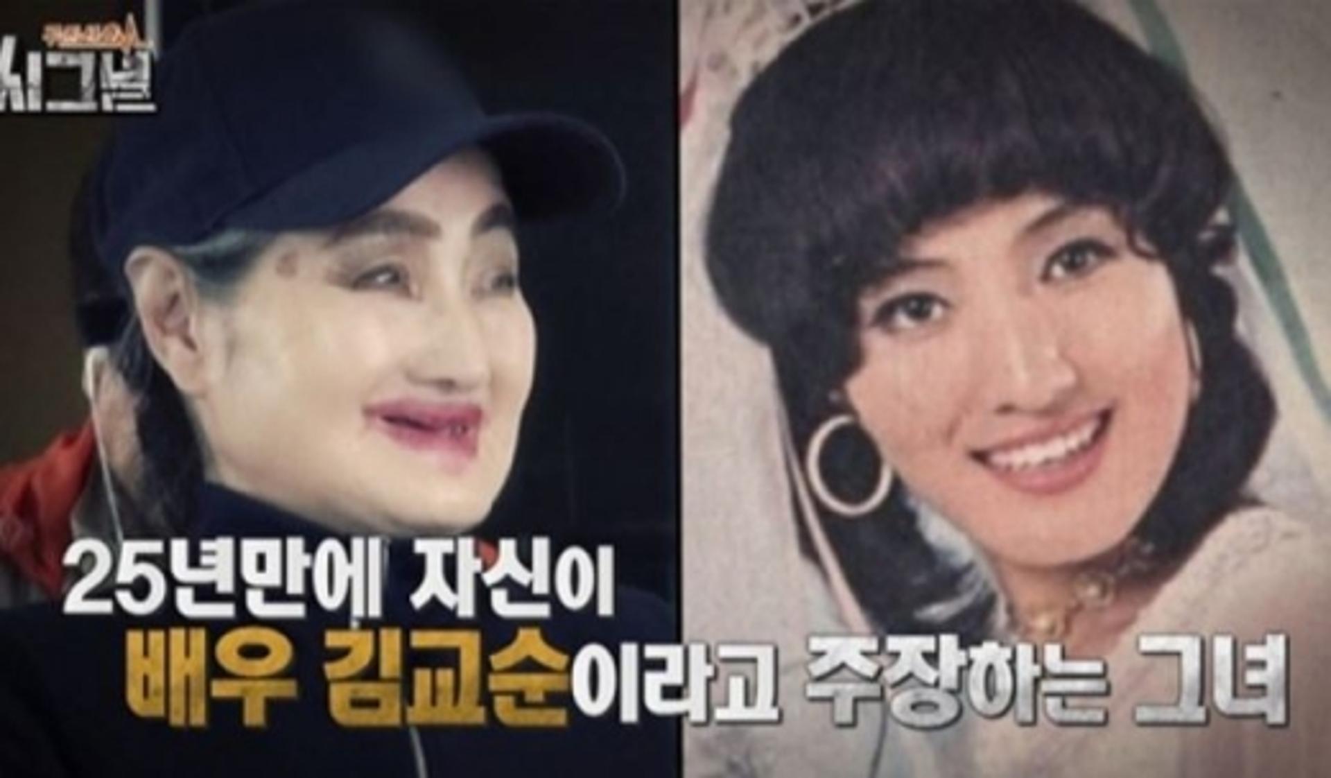 '시그널' 김교순 근황, 펭귄 할머니→조현병 진단 '충격'