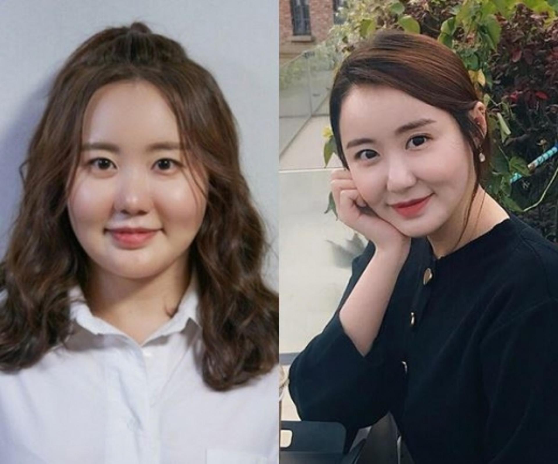 이예림 근황, 9kg 감량 성공?… "물오른 미모"