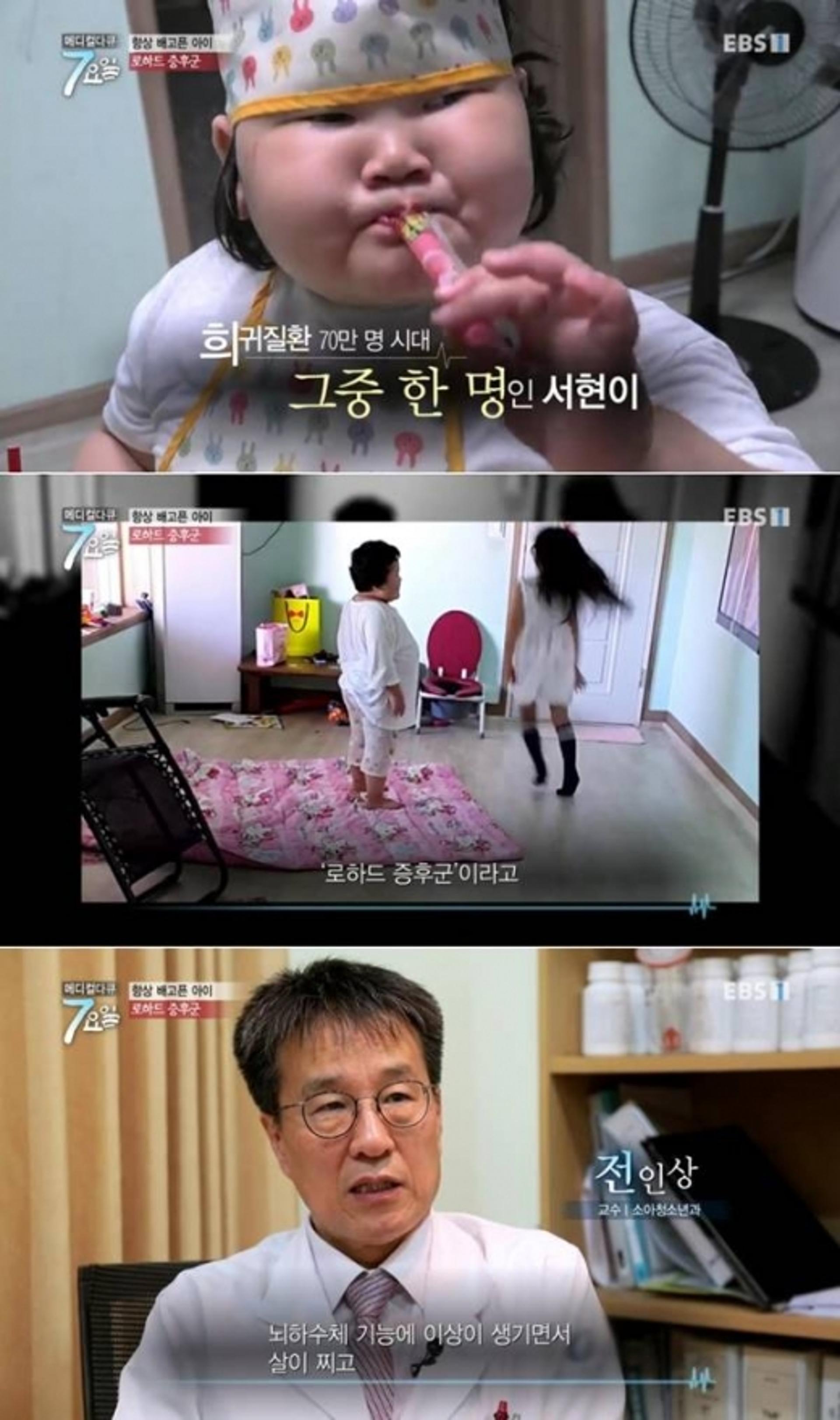 로하드 증후군, 살 빼지 않으면 치명적?
