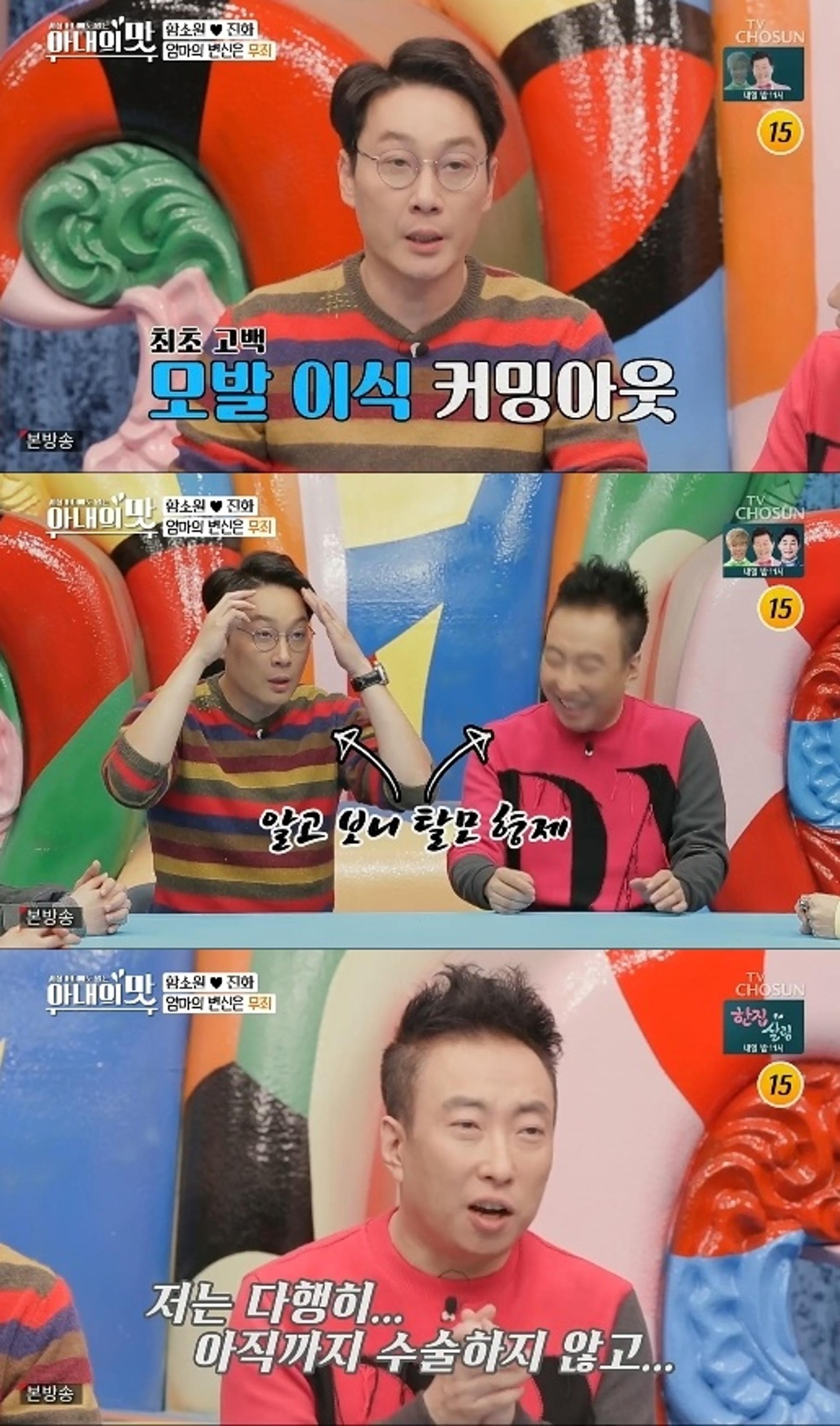'아내의 맛' 이휘재 모발이식 '커밍아웃'… "앞머리 수술했다"