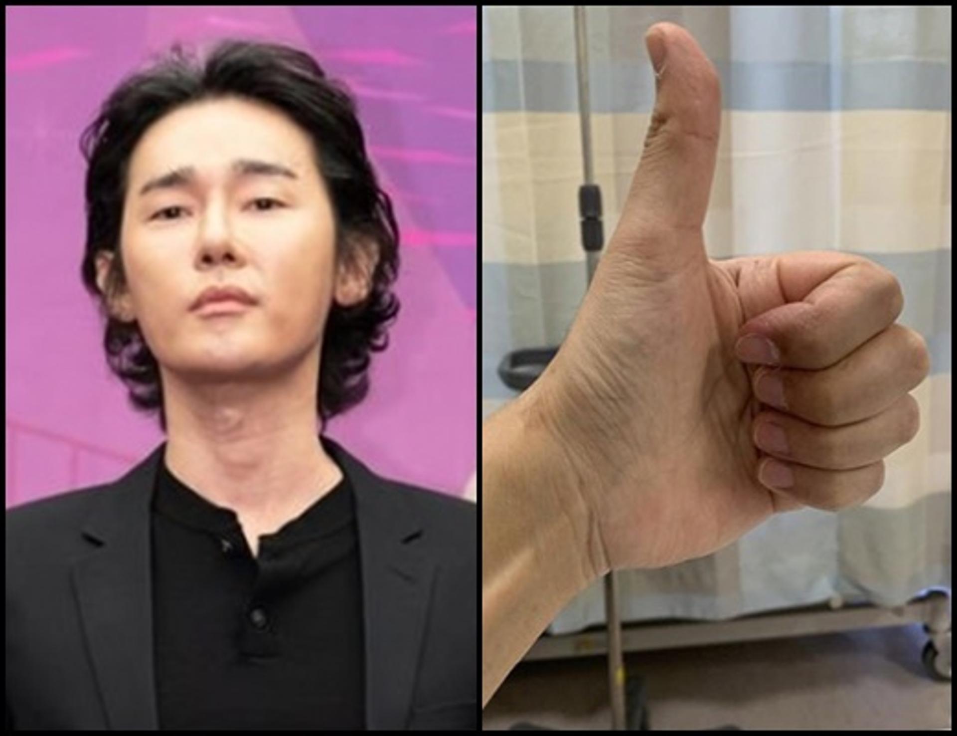 "머리털만 빠지는 줄 알았다"… '암투병' 허지웅 근황
