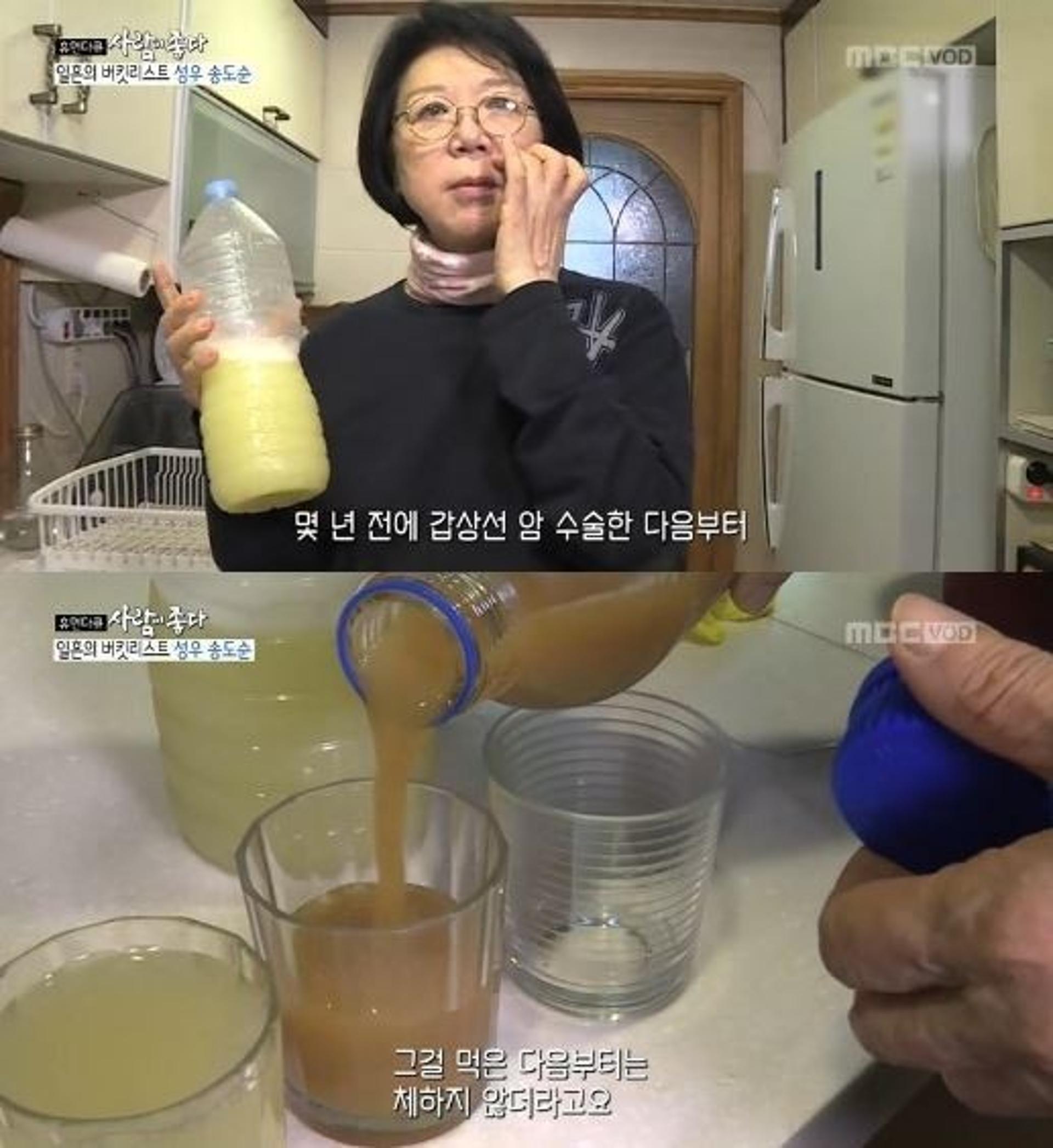 '사람이좋다' 송도순 갑상선암 수술, 현재 상태는?