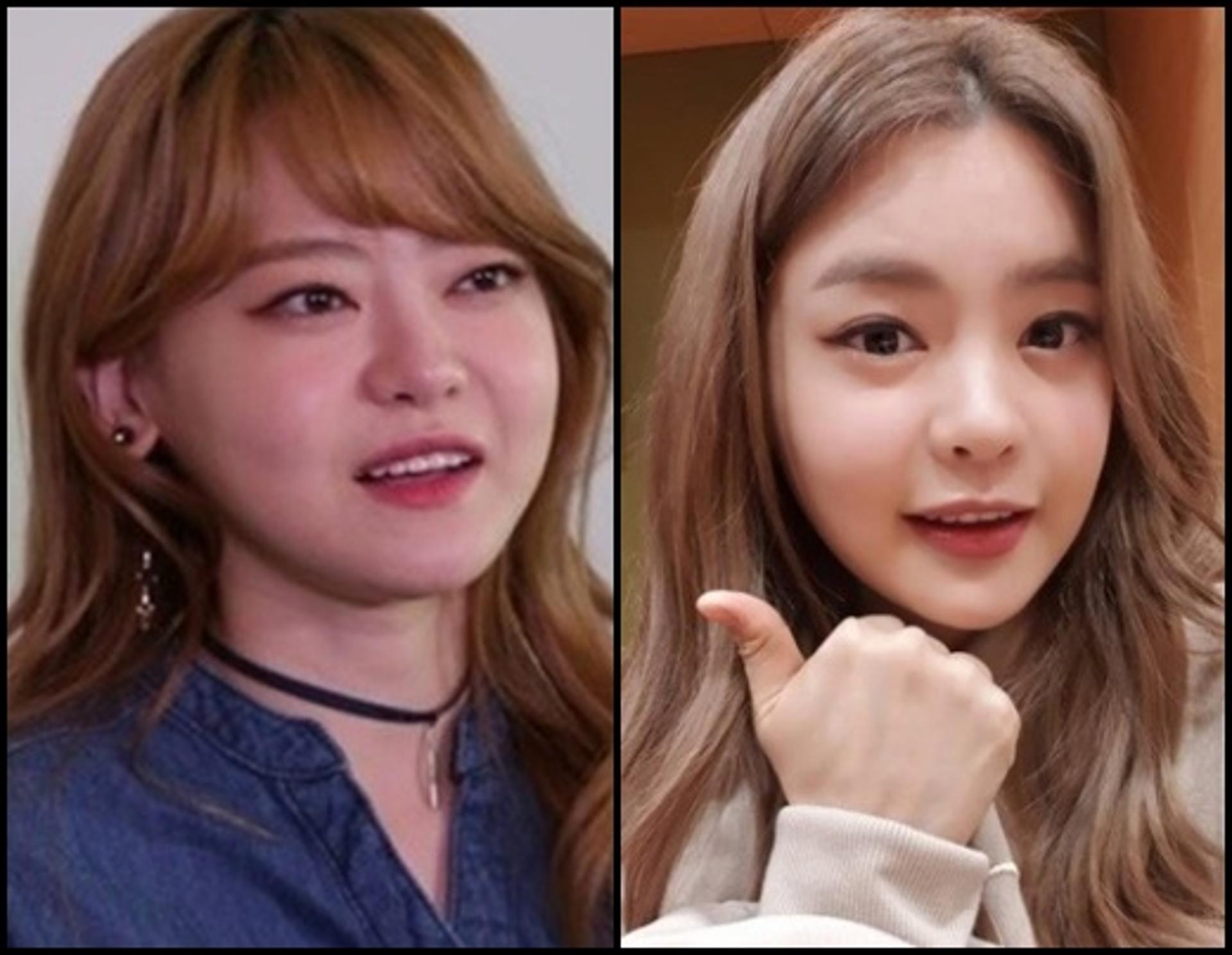 '안병증 완치' 서유리, 성형설 일축… 얼마나 달라졌나