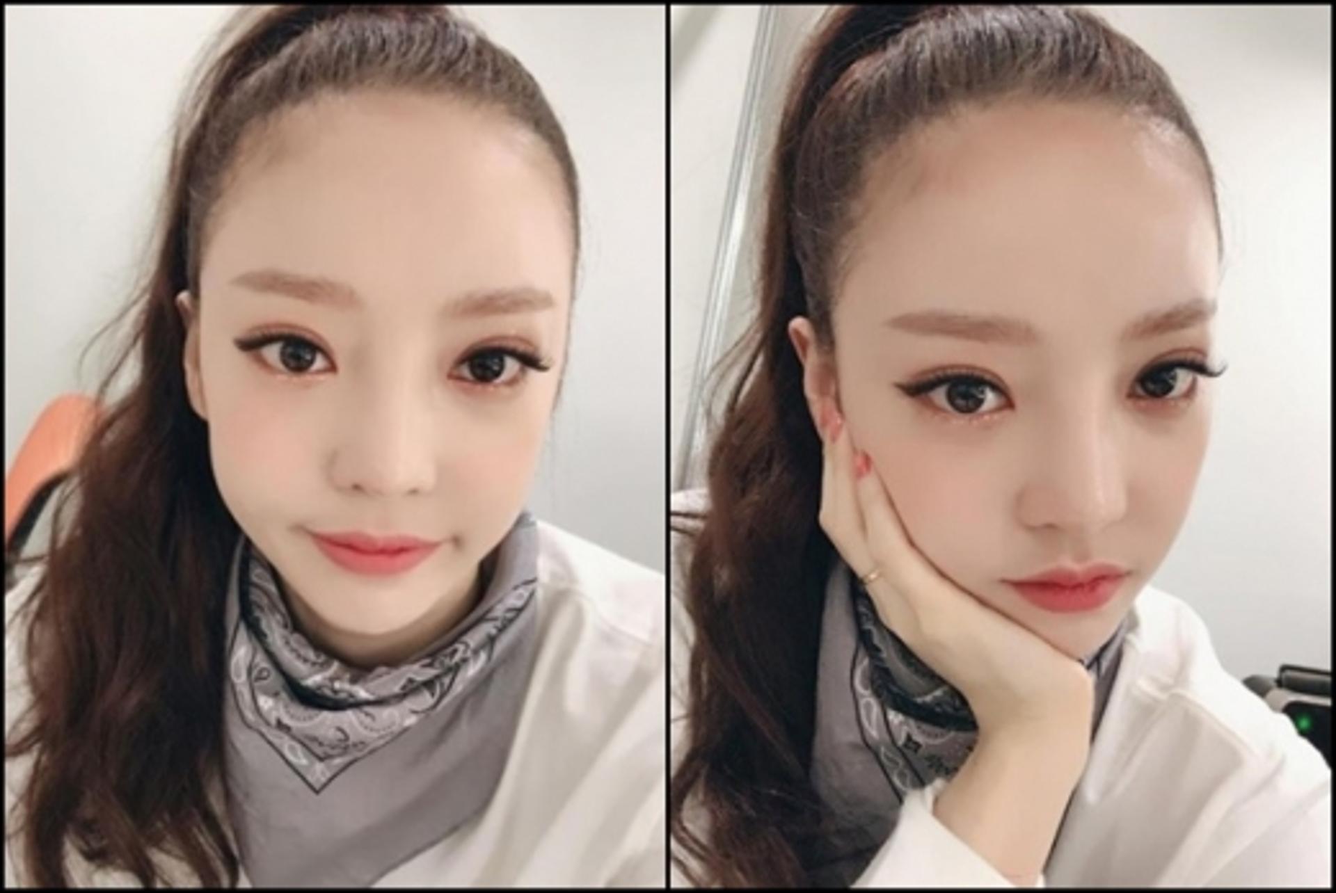 구하라, 셀카 올렸다 '뭇매'… "안검하수가 죄냐"