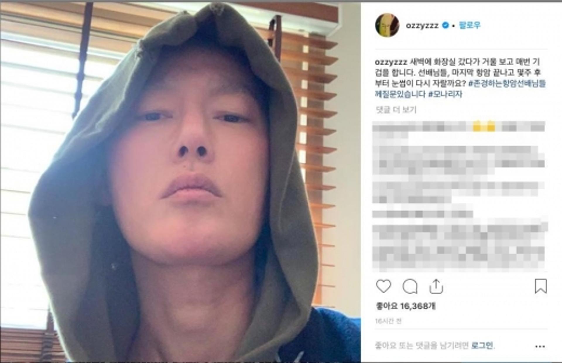 허지웅 투병근황, "눈썹 다시 자랄까요?"