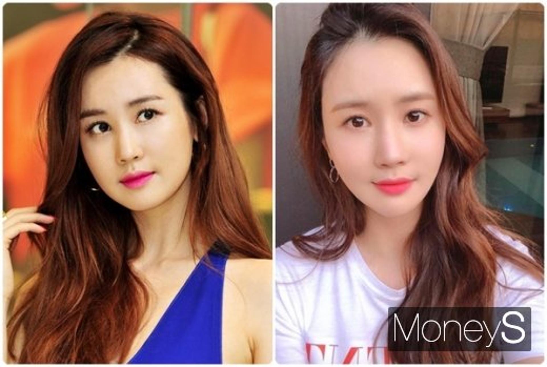 이다해 성형의혹, 얼굴이 달라졌다?… 과거 사진과 비교해보니
