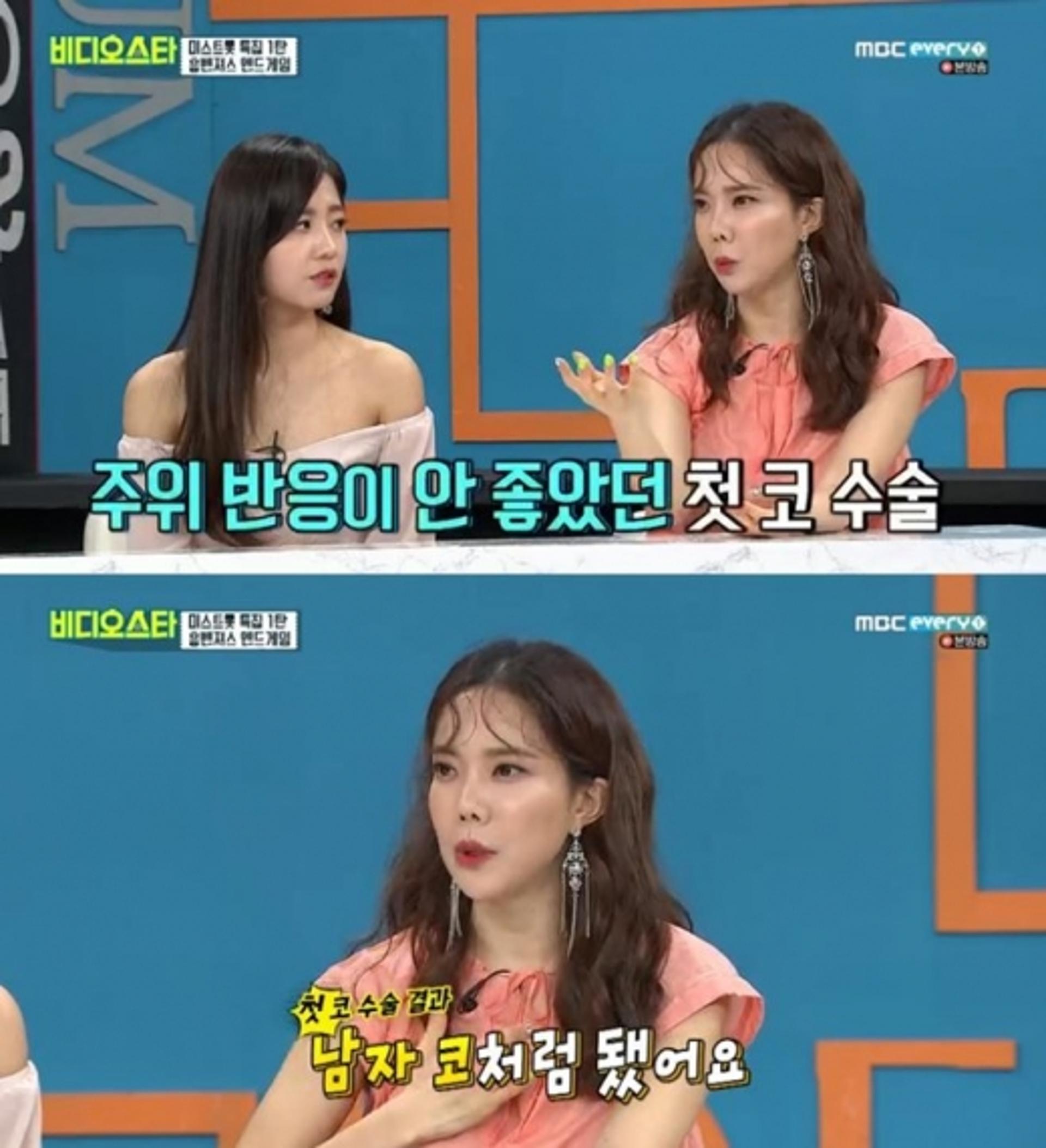 '미스트롯' 김나희, 코 성형만 2번?
