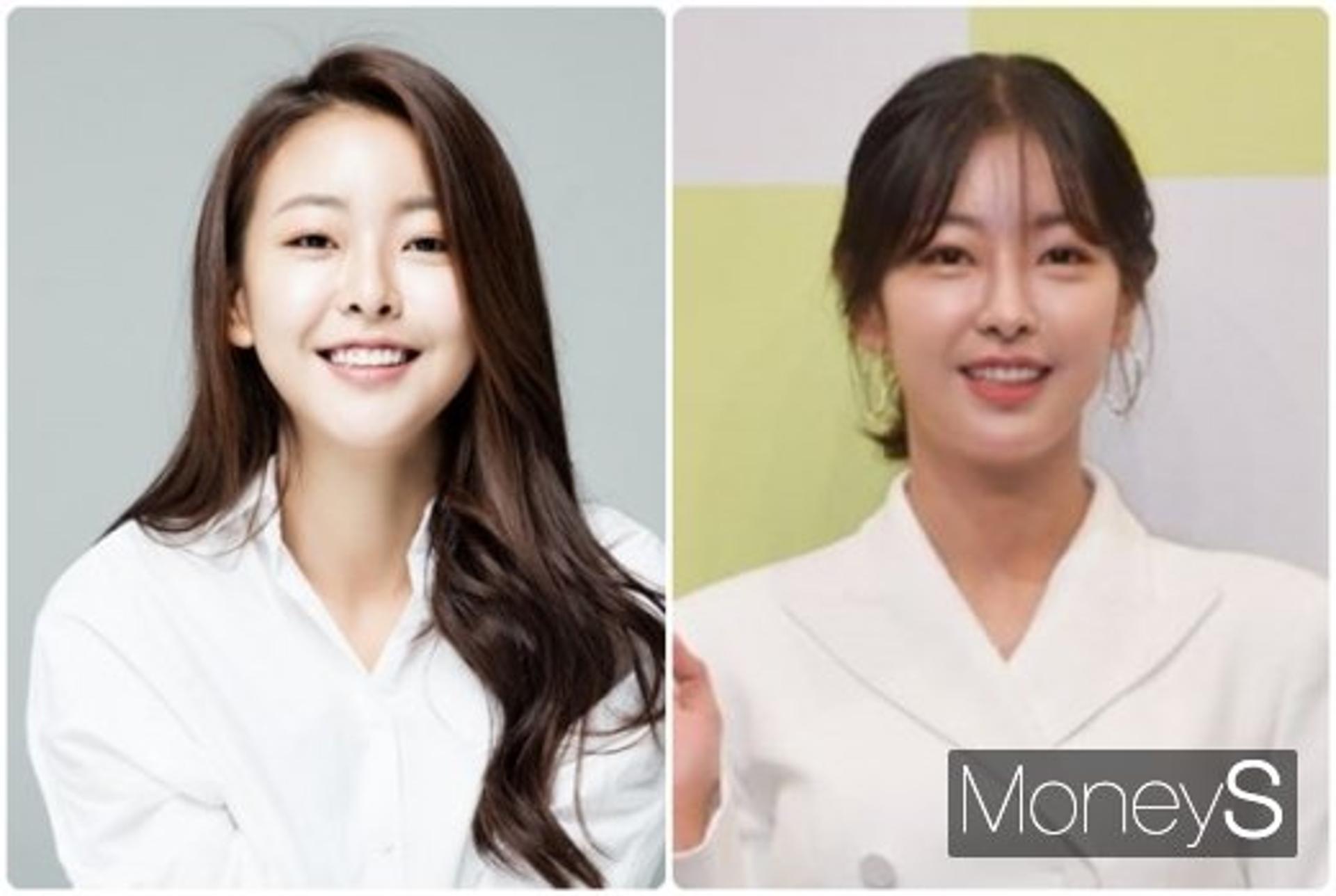 고원희 성형설, 눈매가 확 달라졌다?