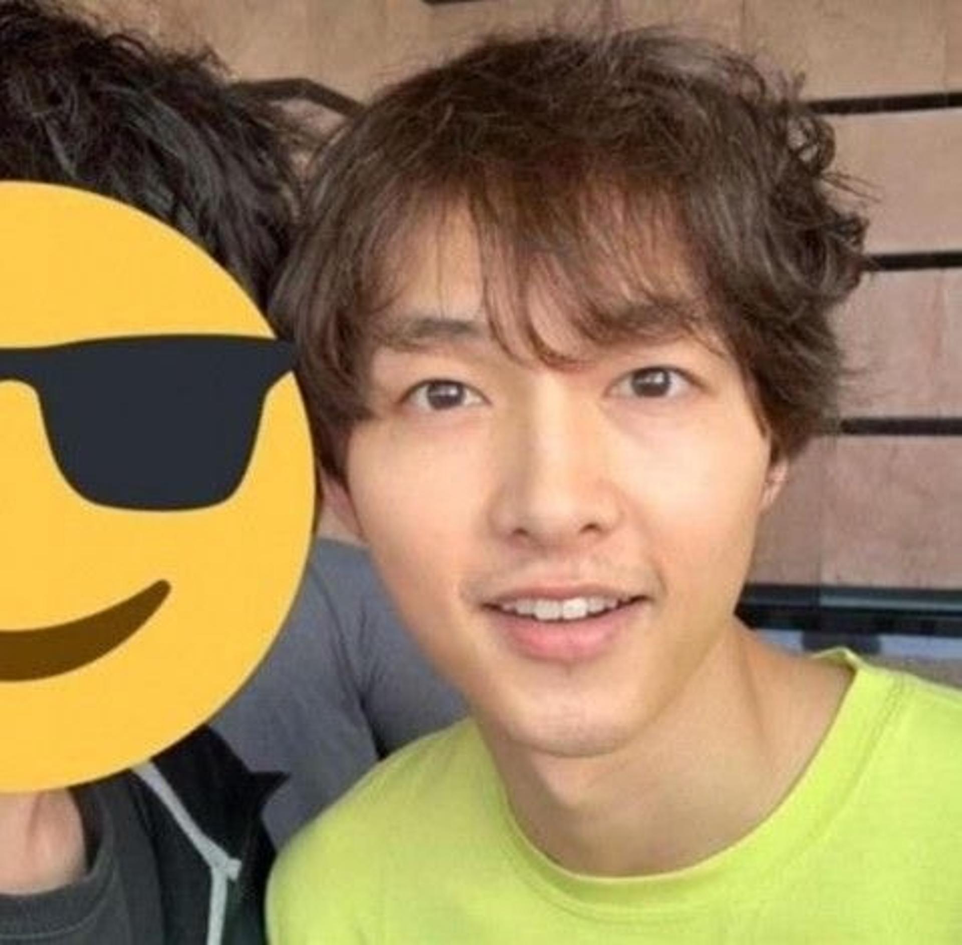 송중기 탈모사진, 스트레스로 얼마나 힘들었으면…