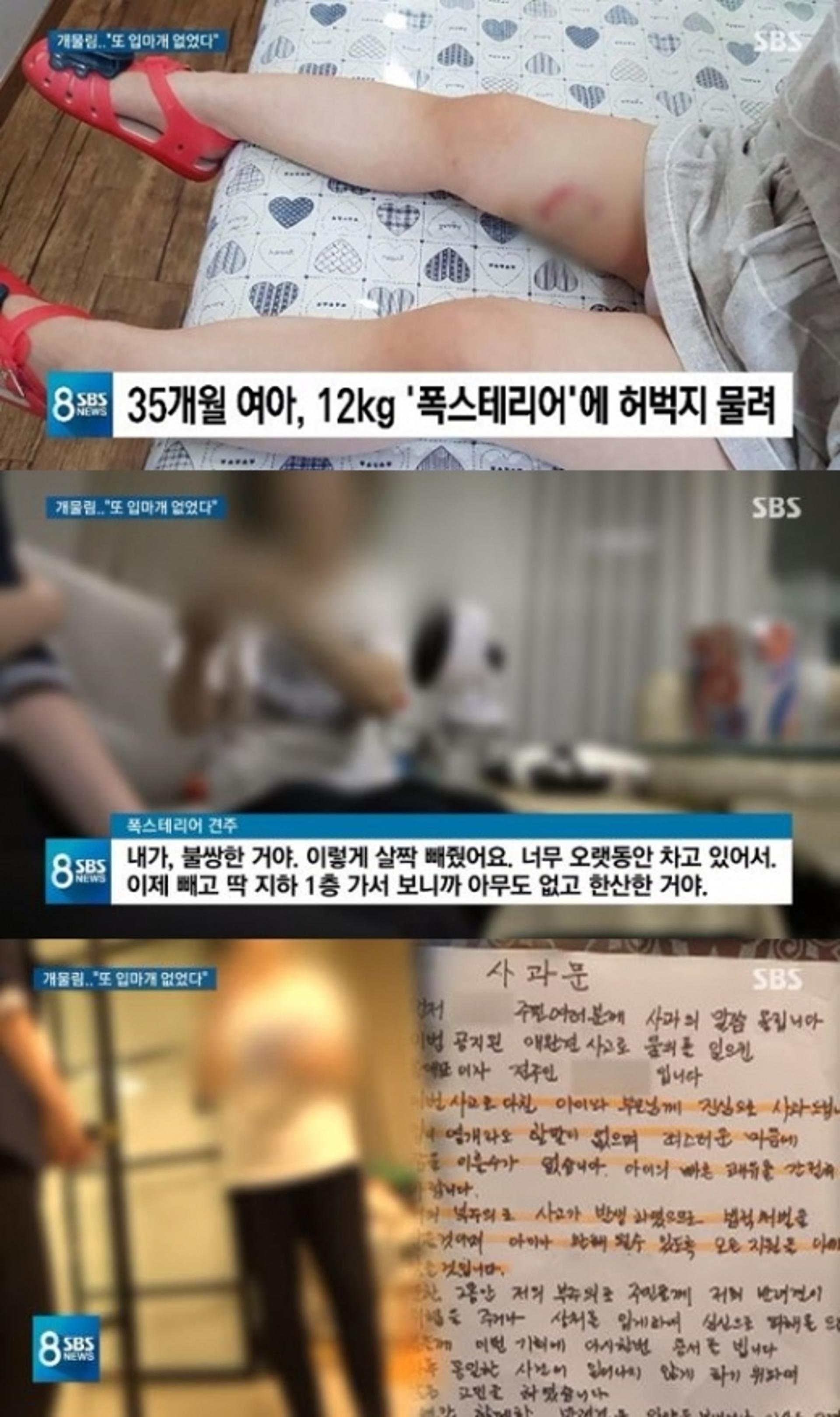 폭스테리어에 물어뜯긴 4세 여아, '입마개 착용' 왜 안했나?