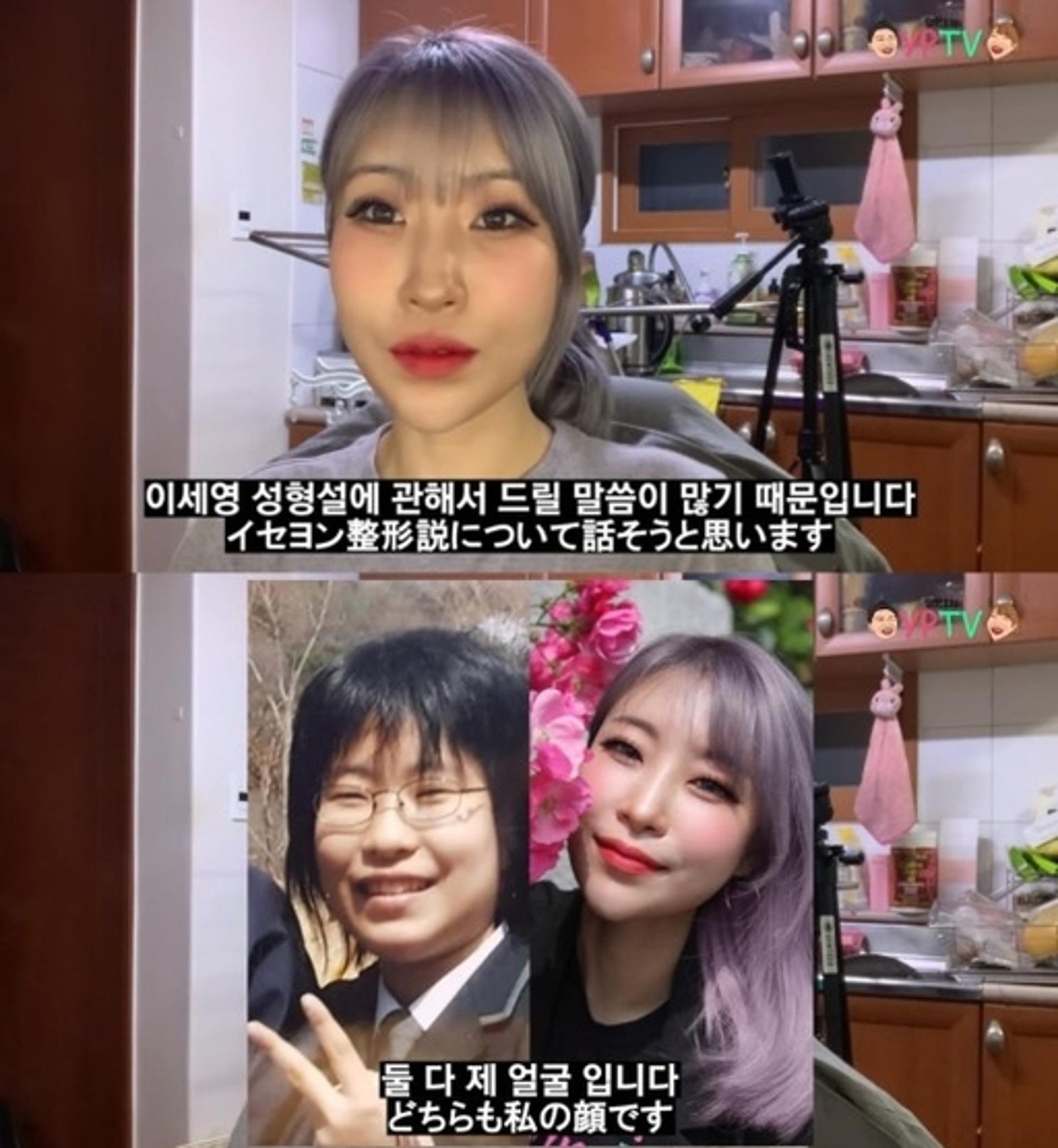 이세영 해명, "성형설? OOO 했다"