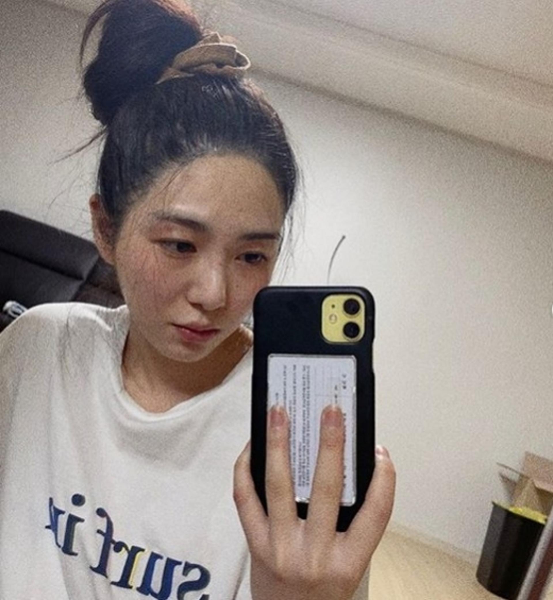 권민아 피부시술 부작용, 얼마나 심각하길래?