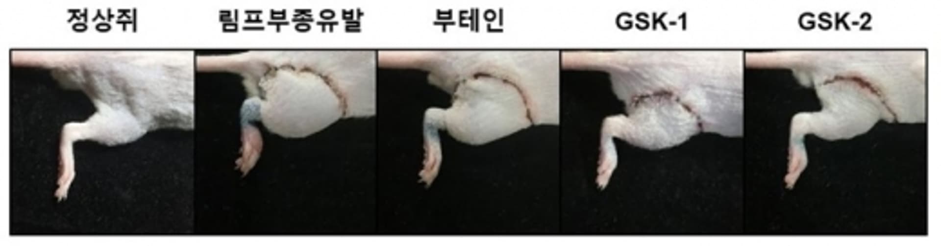 경과원 바이오센터, 난치성 질환 ‘림프부종’ 치료물질 개발
