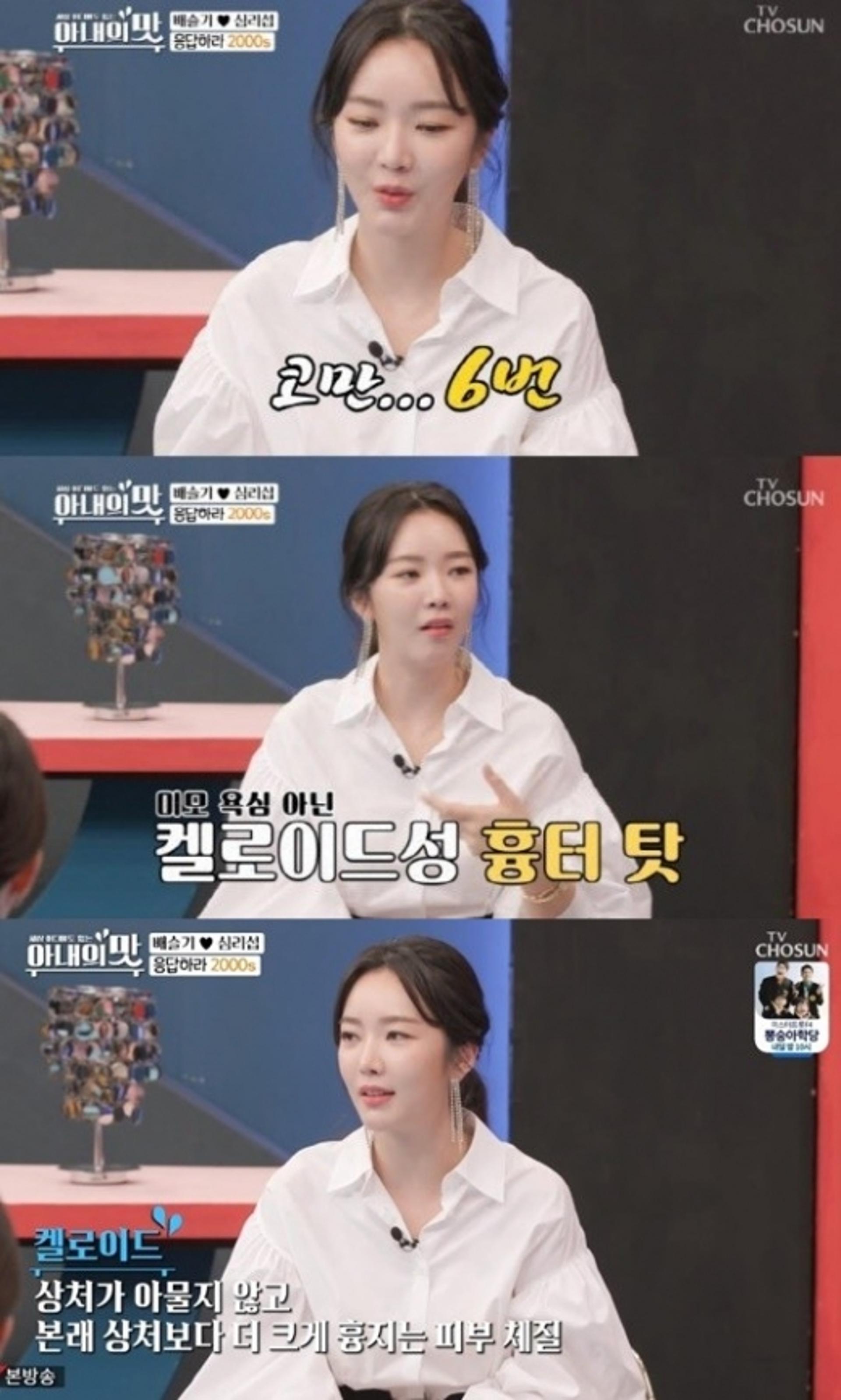 배슬기, 코성형만 6번… 실화야?