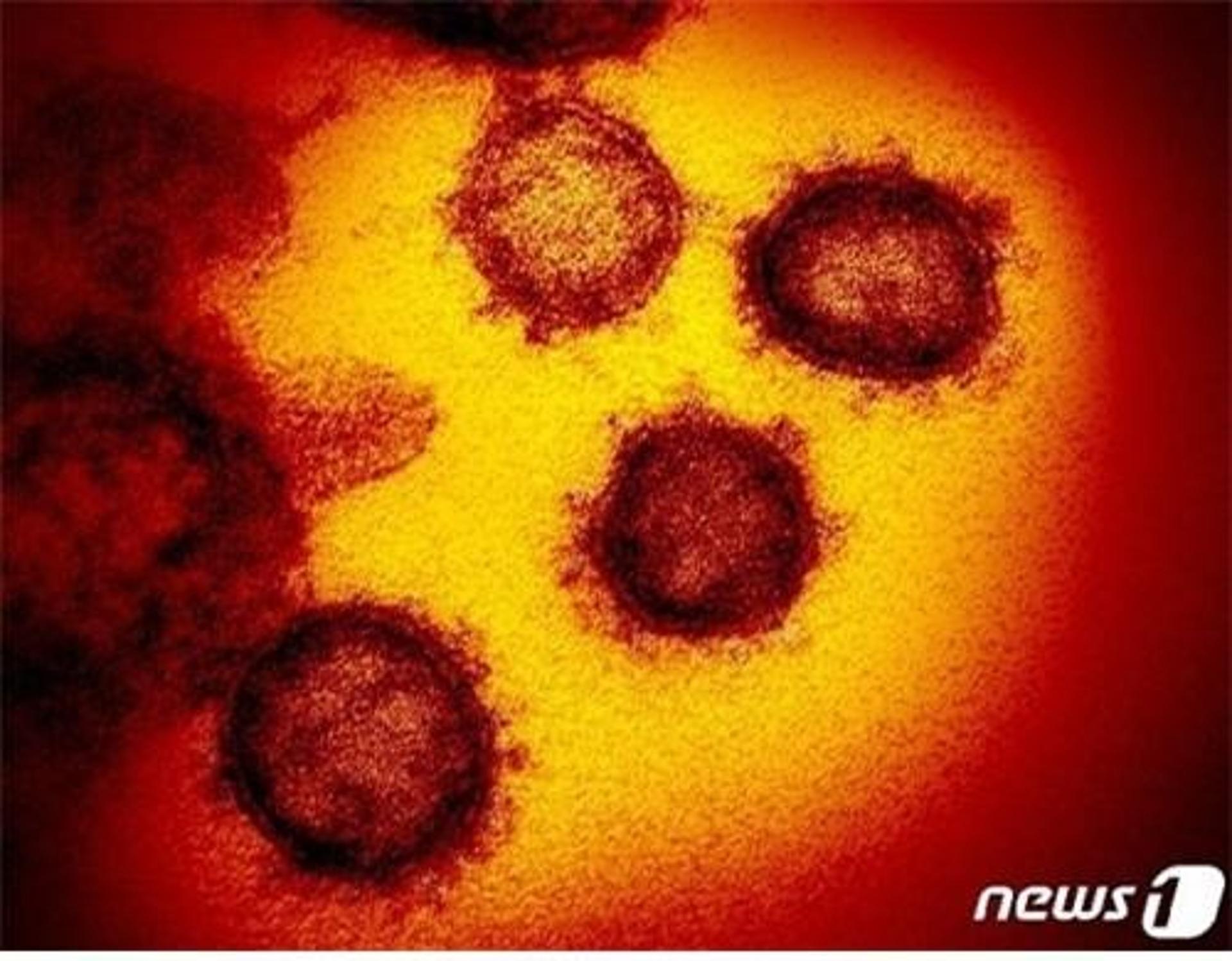 눈 깜짝할 사이 사망… 전세계 덮친 '코로나 재감염' 공포
