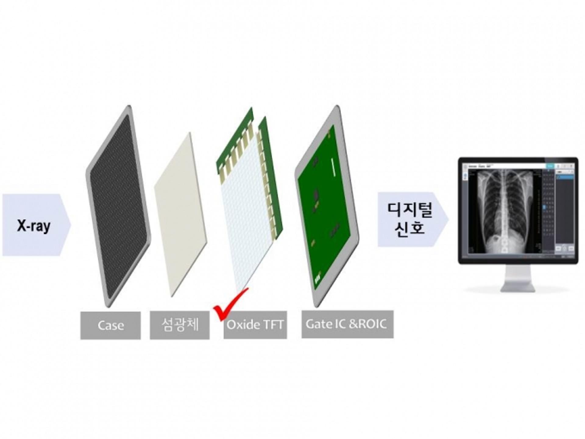 LG디스플레이, 고부가가치 의료용 영상 신시장 진출