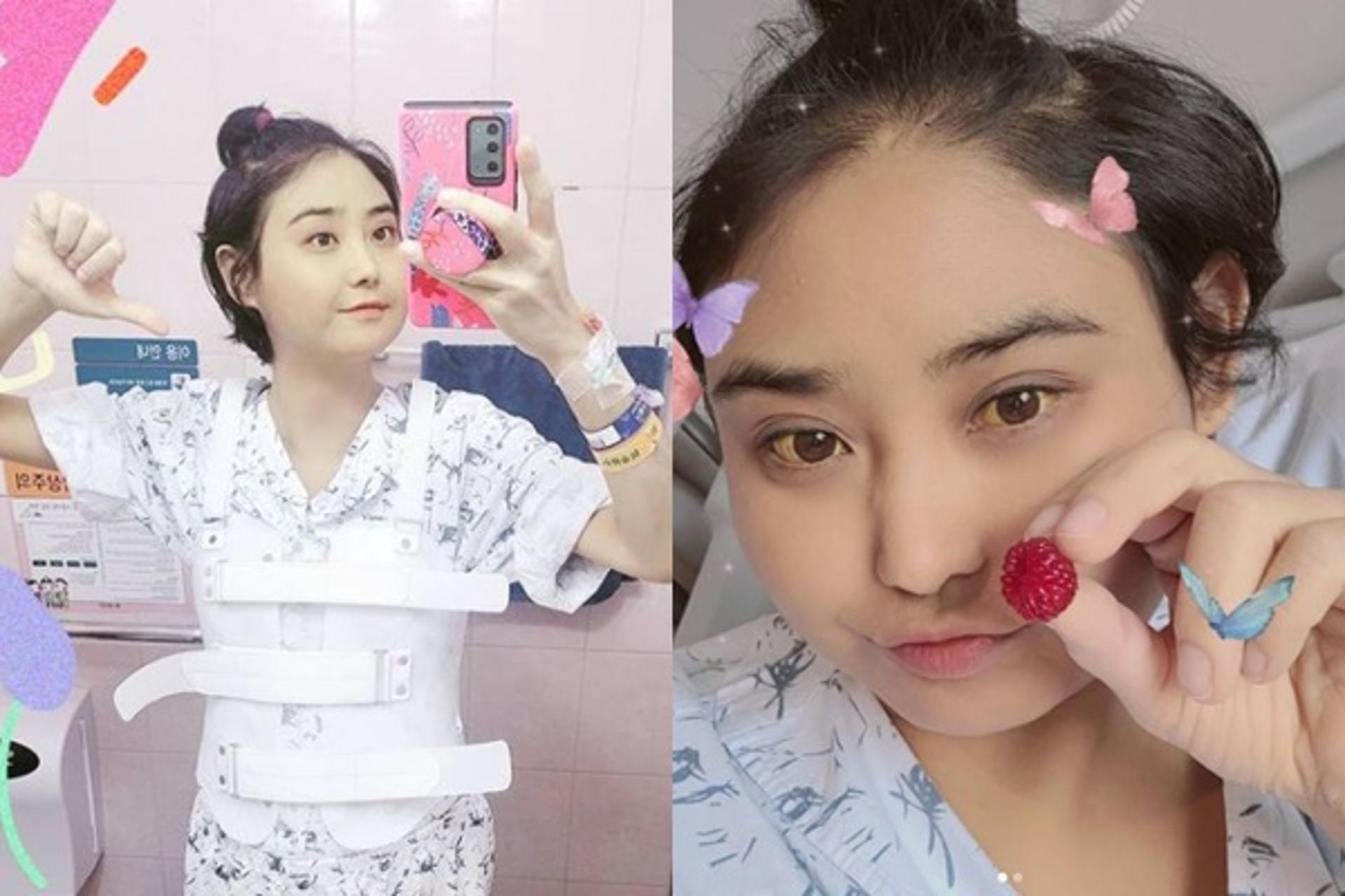 배우 윤주 누구… 급성간부전으로 흉추골절상?