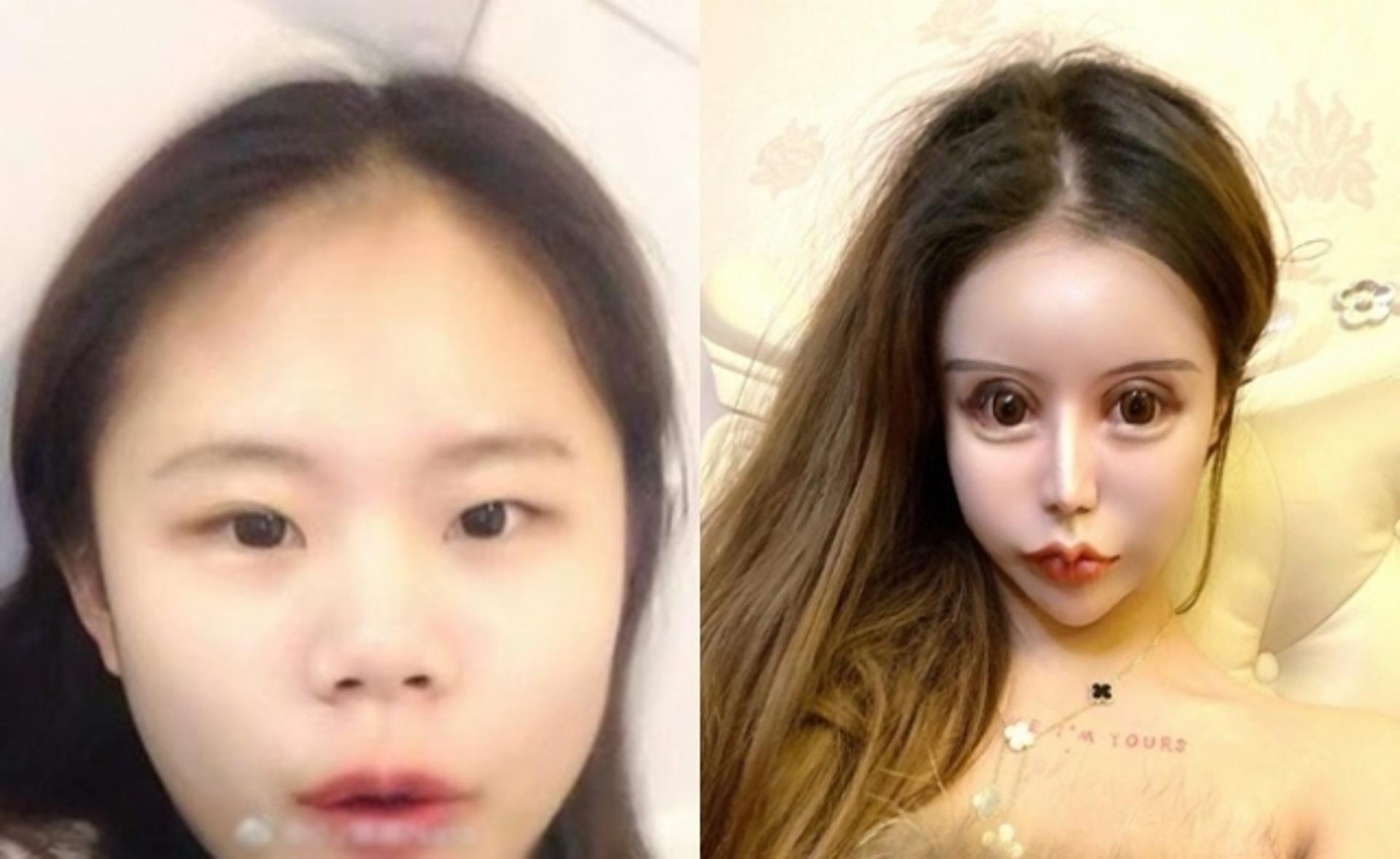 "성형수술 100번 했어요"… 만화 캐릭터 같은 얼굴 '헉'