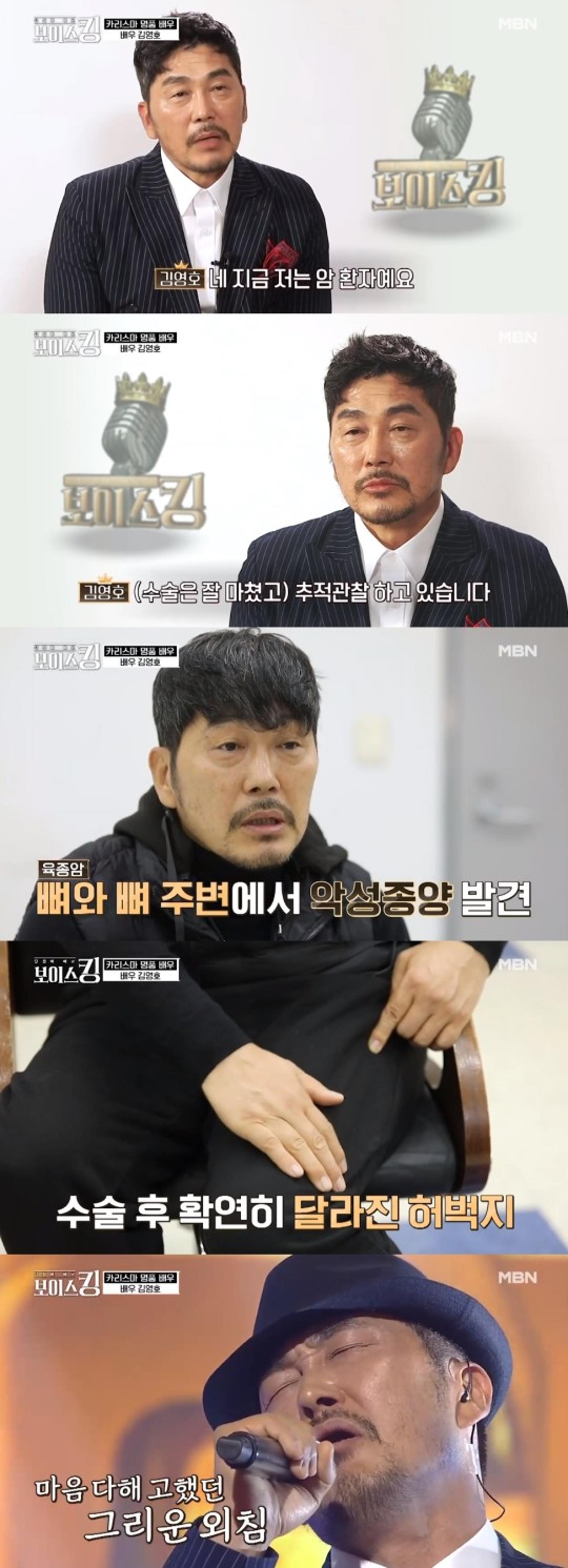 '보이스킹' 김영호 "육종암 투병중, 허벅지 근육 잘라내"