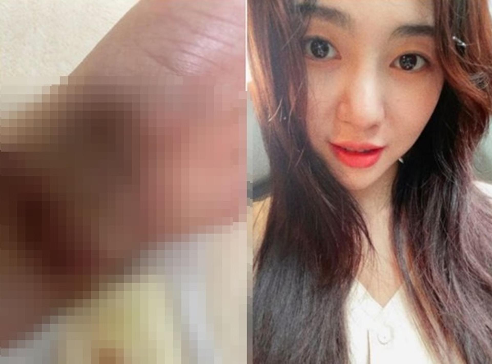 "왜 더럽나?"… 권민아. 간호사 태도 지적→ 극단적 선택 시도