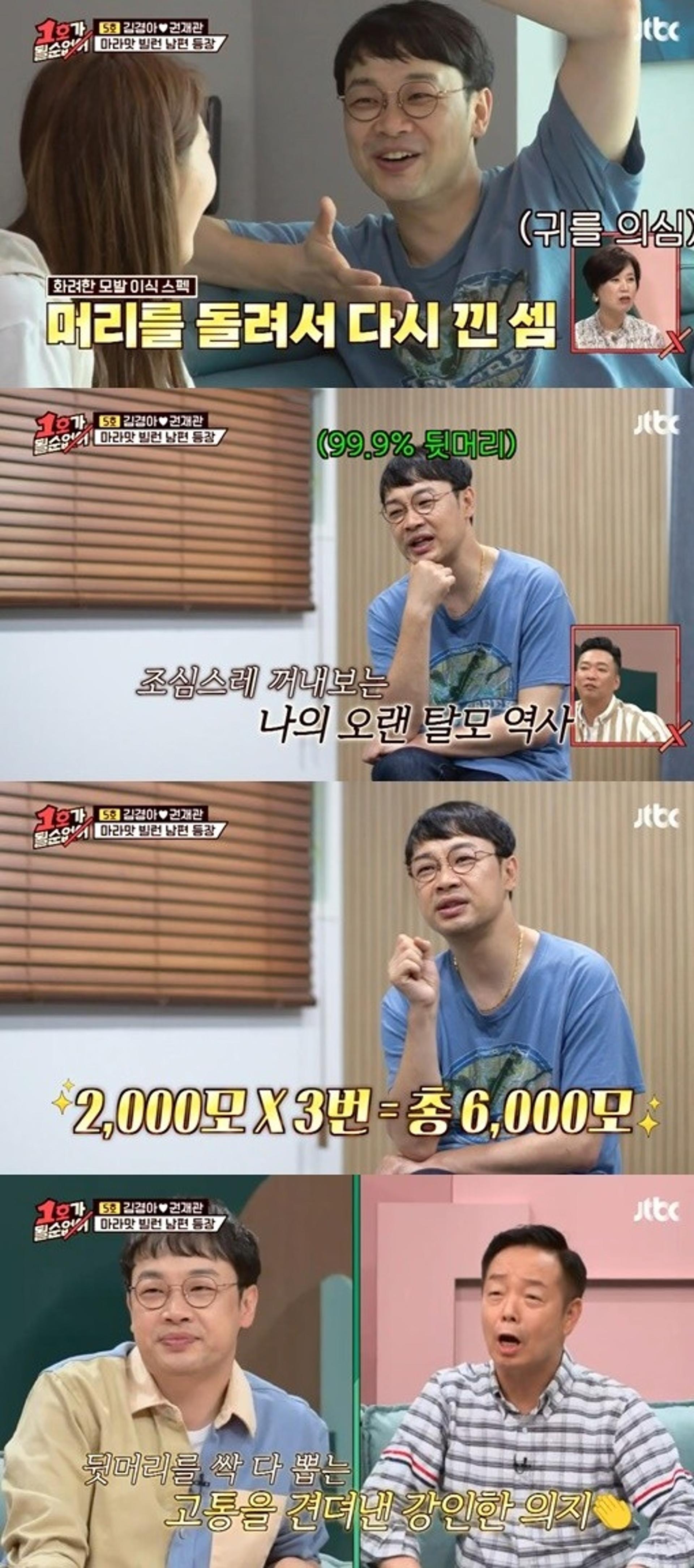 "2000모? 눈썹수준"…'1호가' 권재관, 모발이식 끝판왕 등극