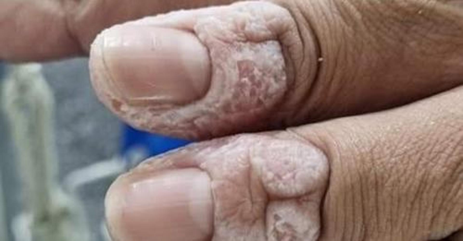"간호직 공무원 정원 늘려주세요"…'인력확대' 청와대 청원 동의 4만명 넘겨