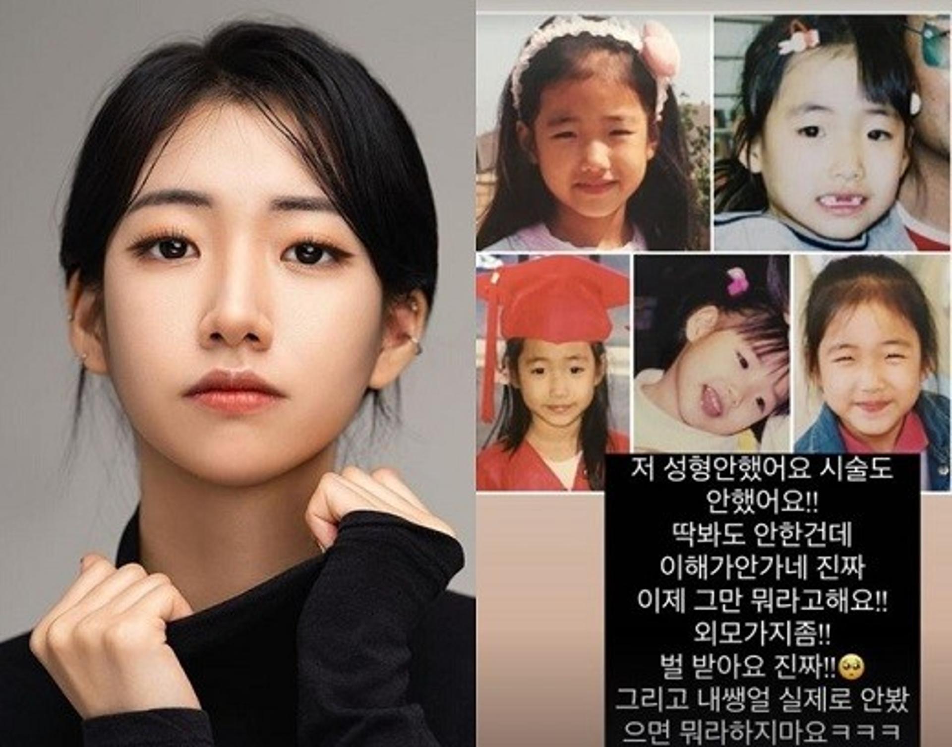 "성형? 시술도 안했는데"… 배동성 딸 배수진, 과거사진 공개