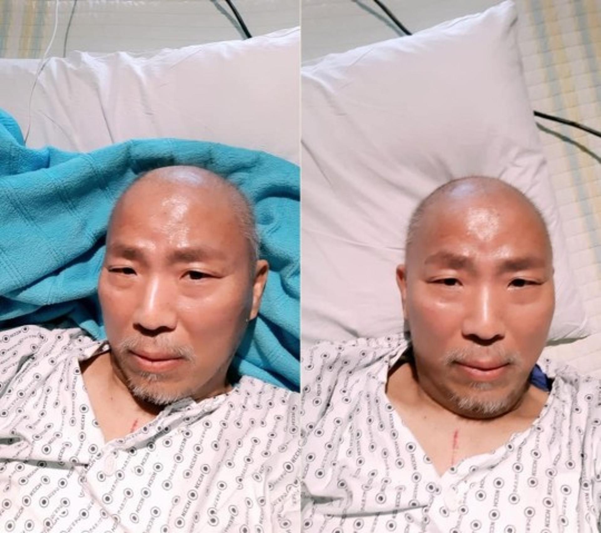 "3번째 100만원 후원 감사"… '폐암 투병' 김철민 근황
