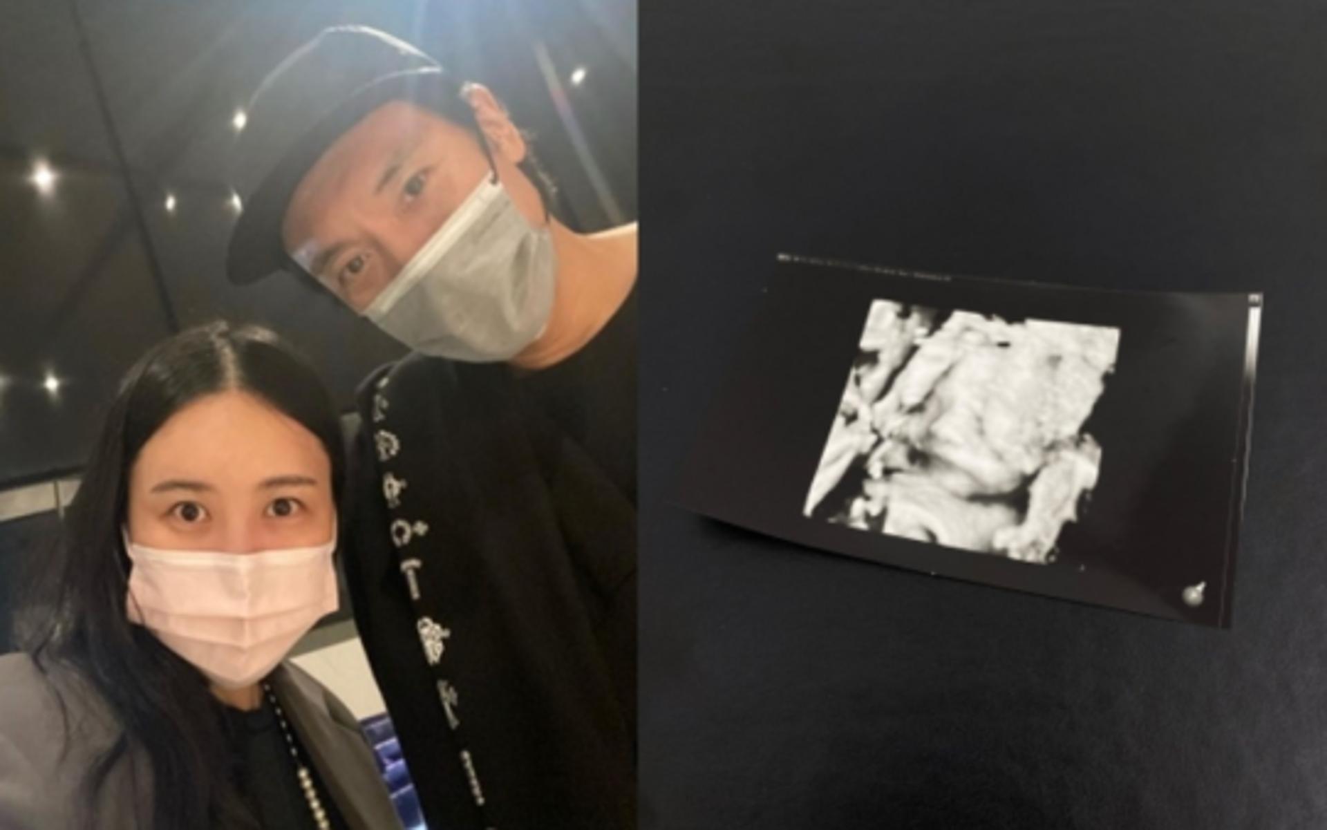 삼촌이 GD라니… 권다미♥김민준 임신, 부모된다