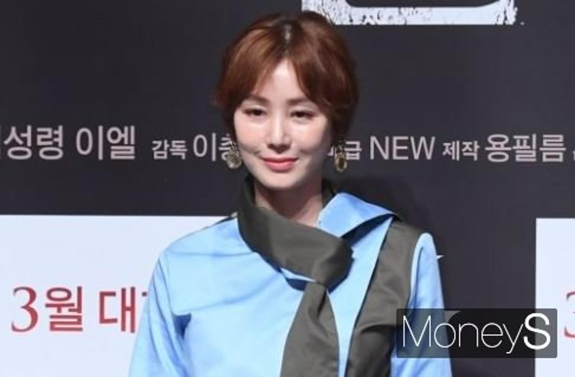 김성령 "성대에 매달 보톡스 맞아"… 연축성 발성장애란?