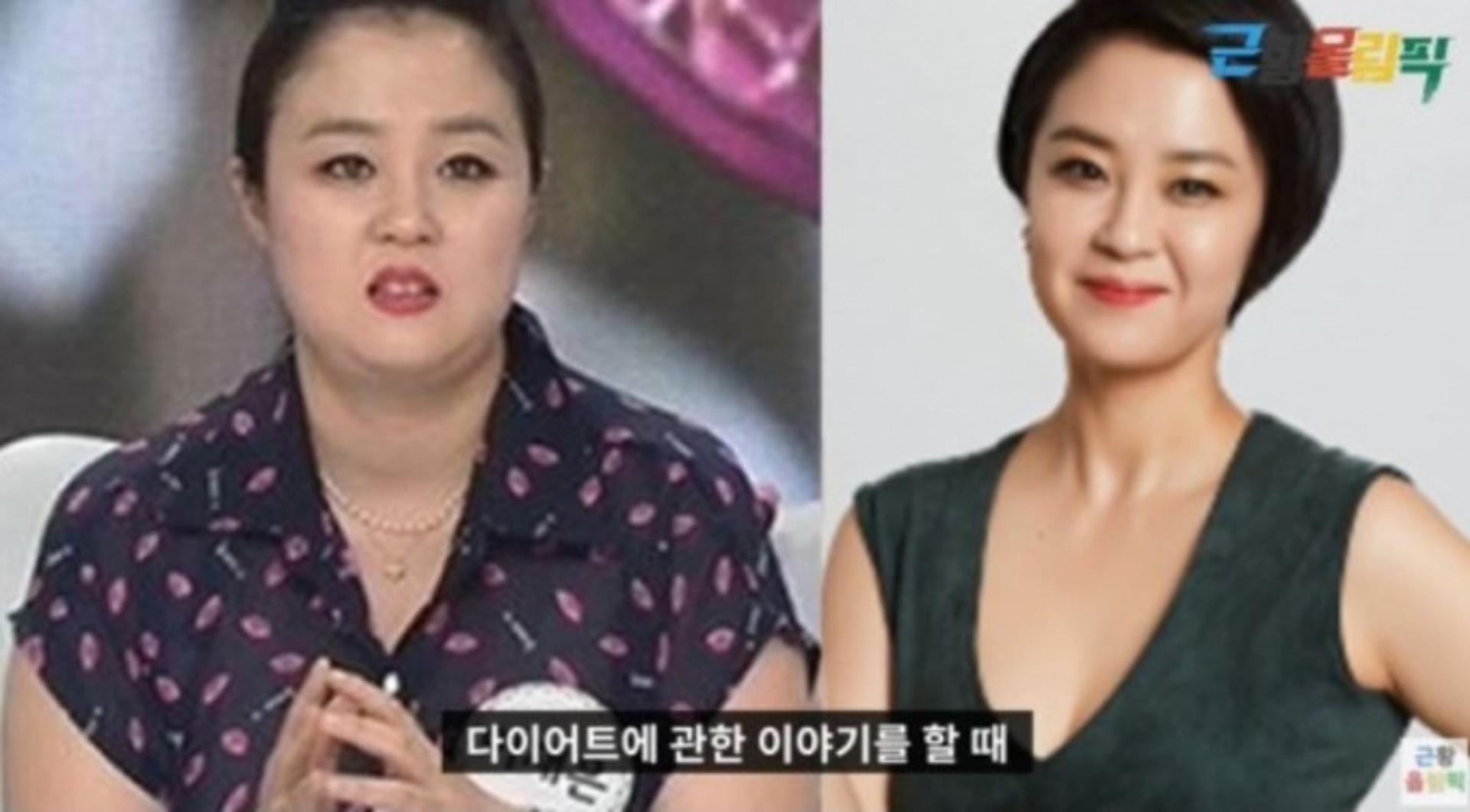 "체중 80㎏ 넘기도"… 이재은, 대인기피증 고백