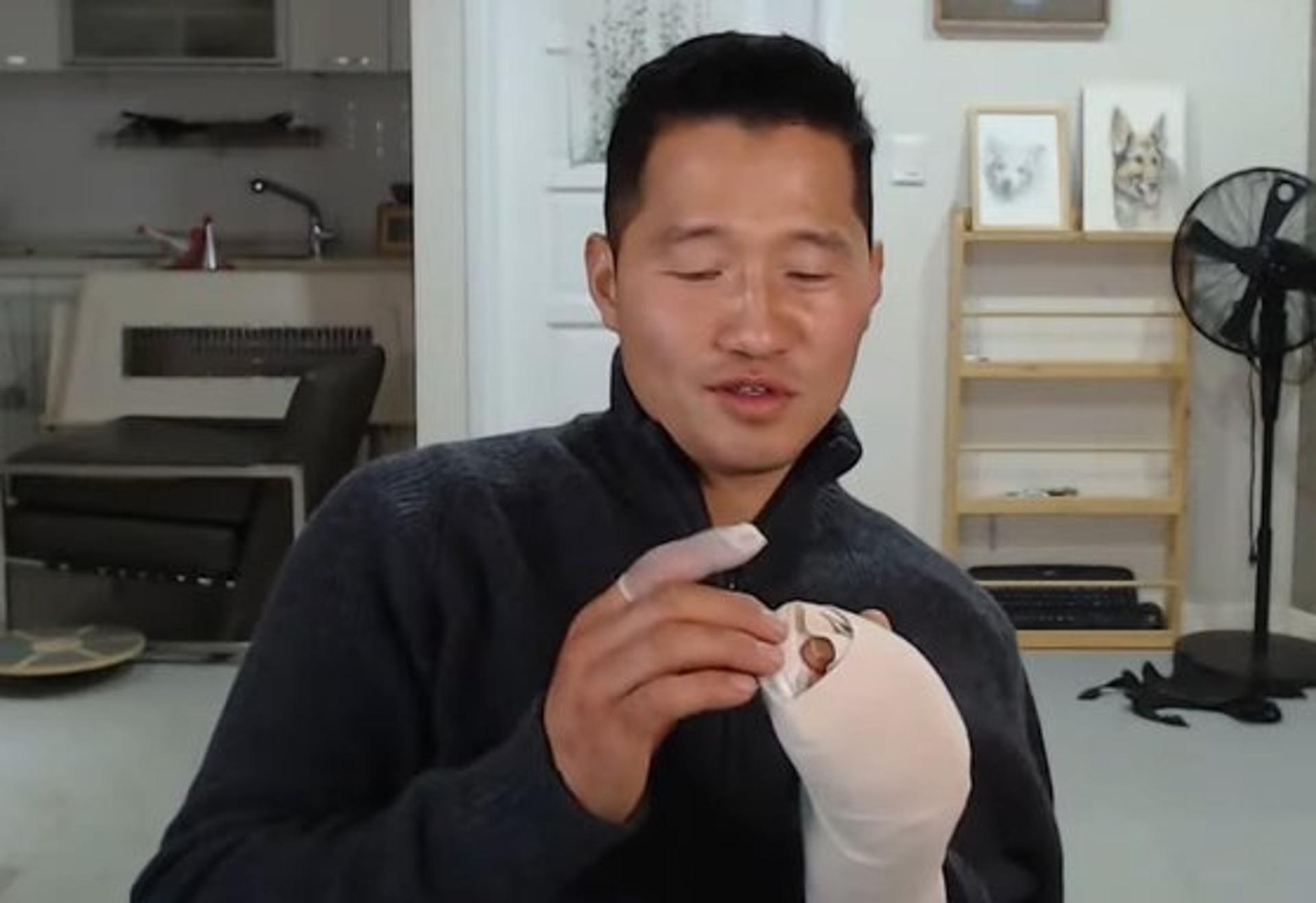 개물림 사고, 강형욱 "피 분수처럼 튀어… 사극인 줄"