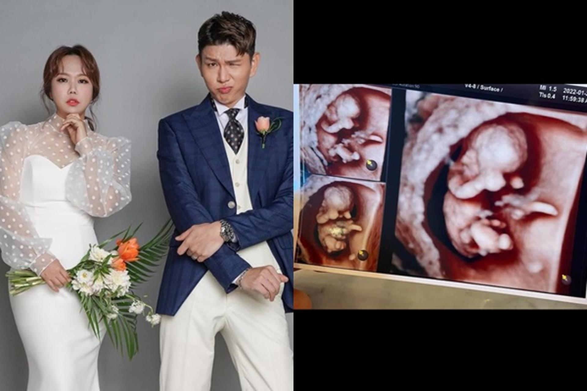 "반가워 아빠야"…'제이쓴♥' 홍현희 임신, 결혼 4년만에 부모된다