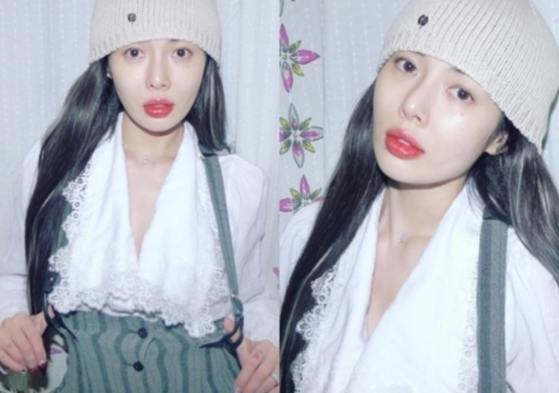 '던♥' 현아, 목에 보석을?… 보기만 해도 아픈 '피어싱'