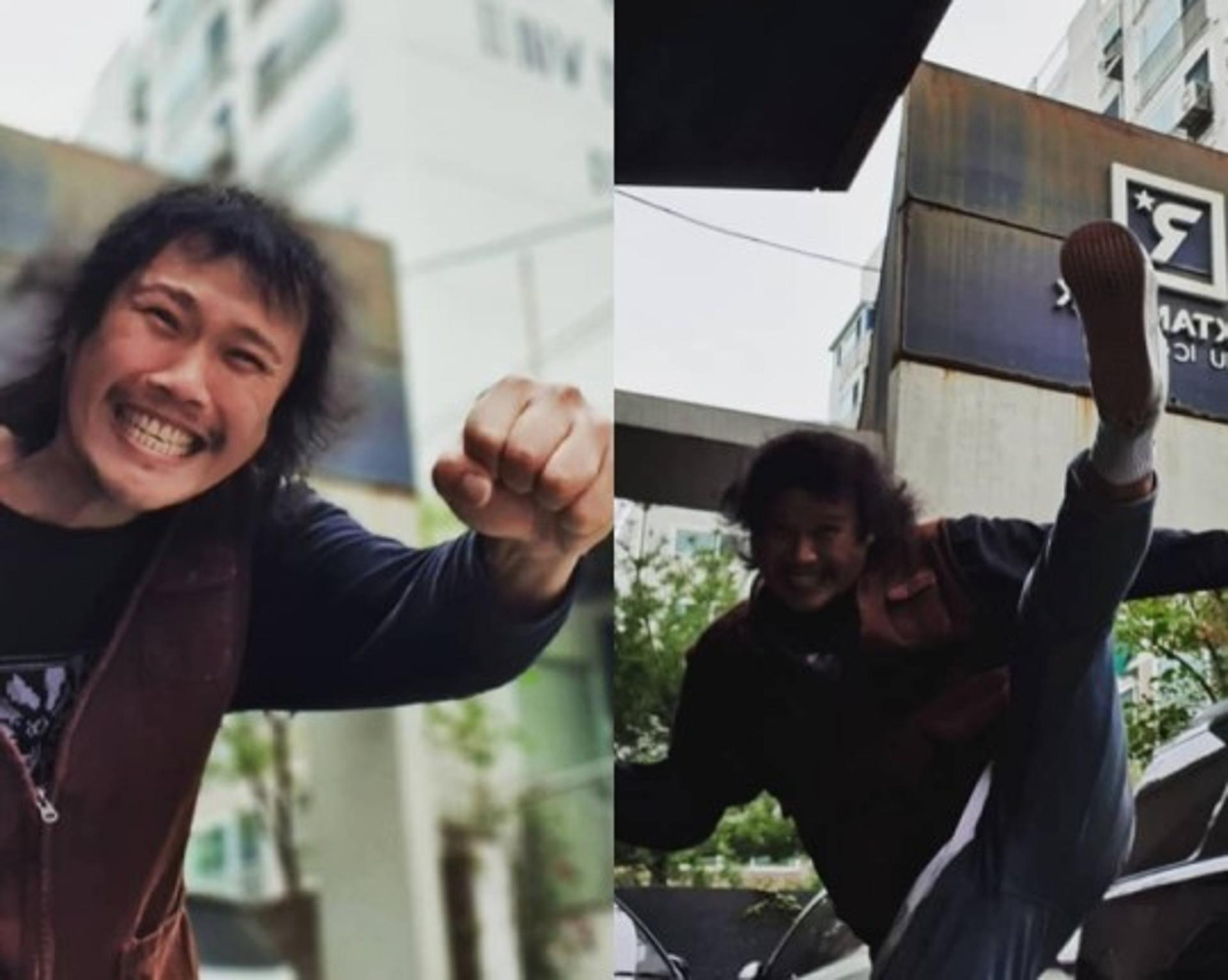 "다이어트=성형?!" …'15kg 감량' 유명가수, 분노한 사연