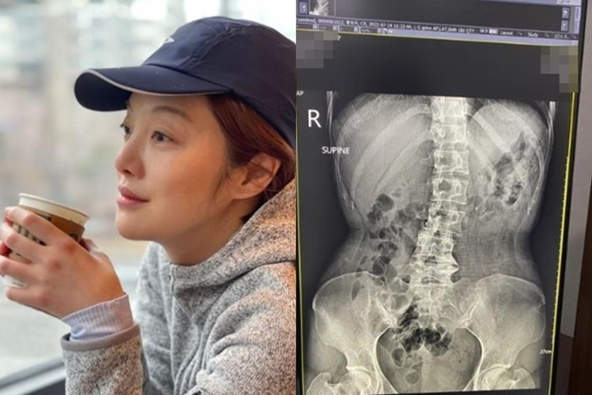"심각하다"… '김용건 예비며느리' 황보라, 건강 이상?