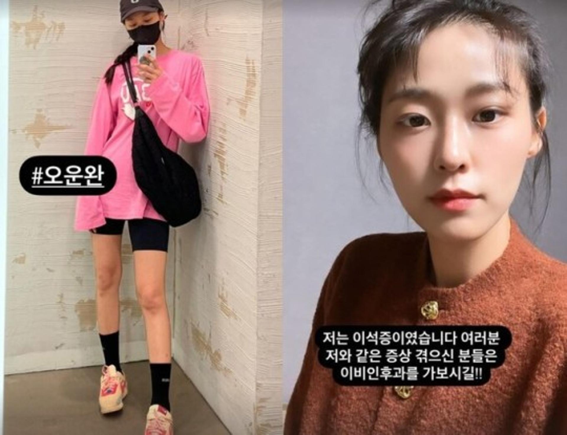 현실 끊긴 영상통화 같다더니… 설현 "이석증이었습니다"