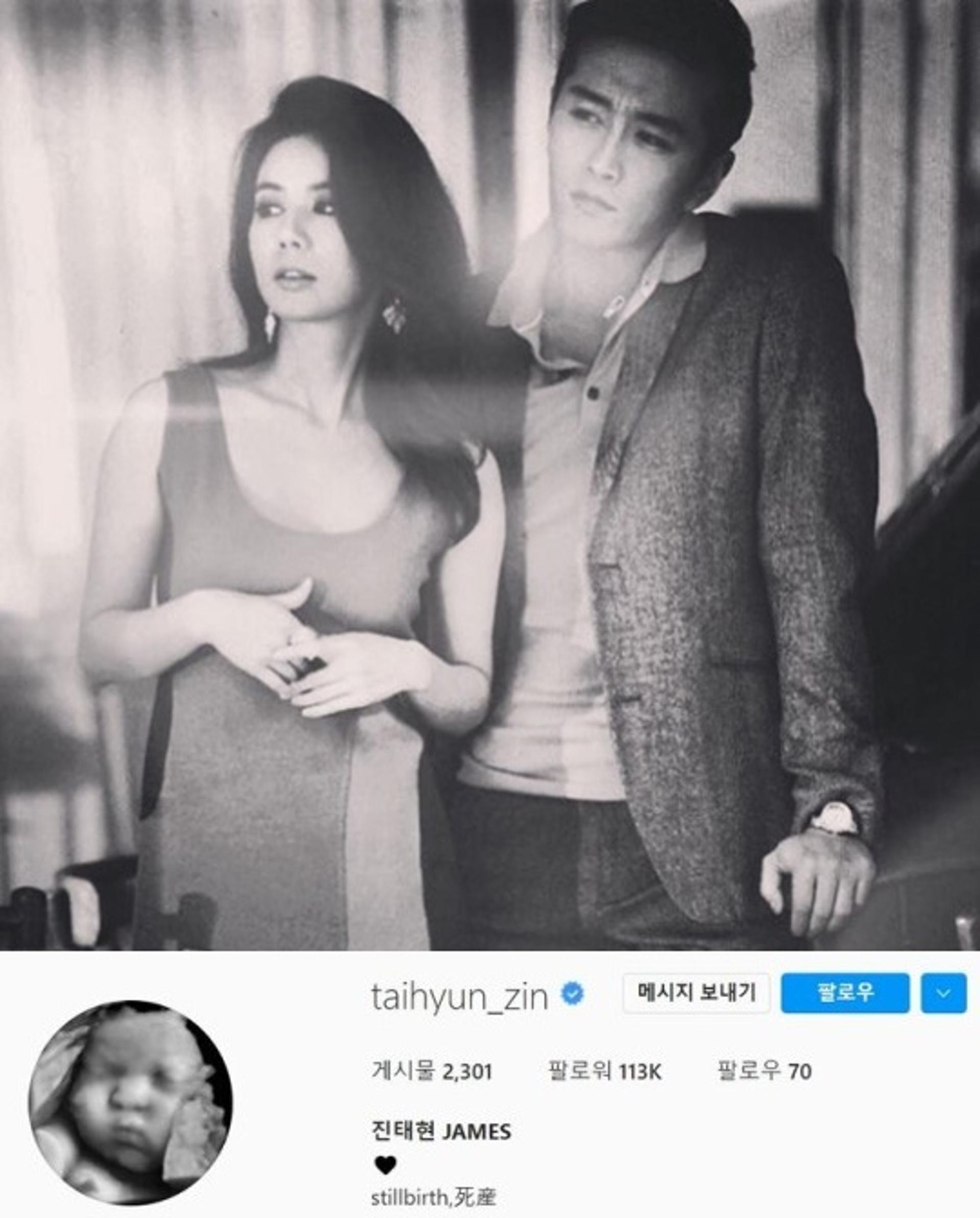 '박시은♥' 진태현, 유산 아픔 속 SNS 프로필 '사산'(死産)