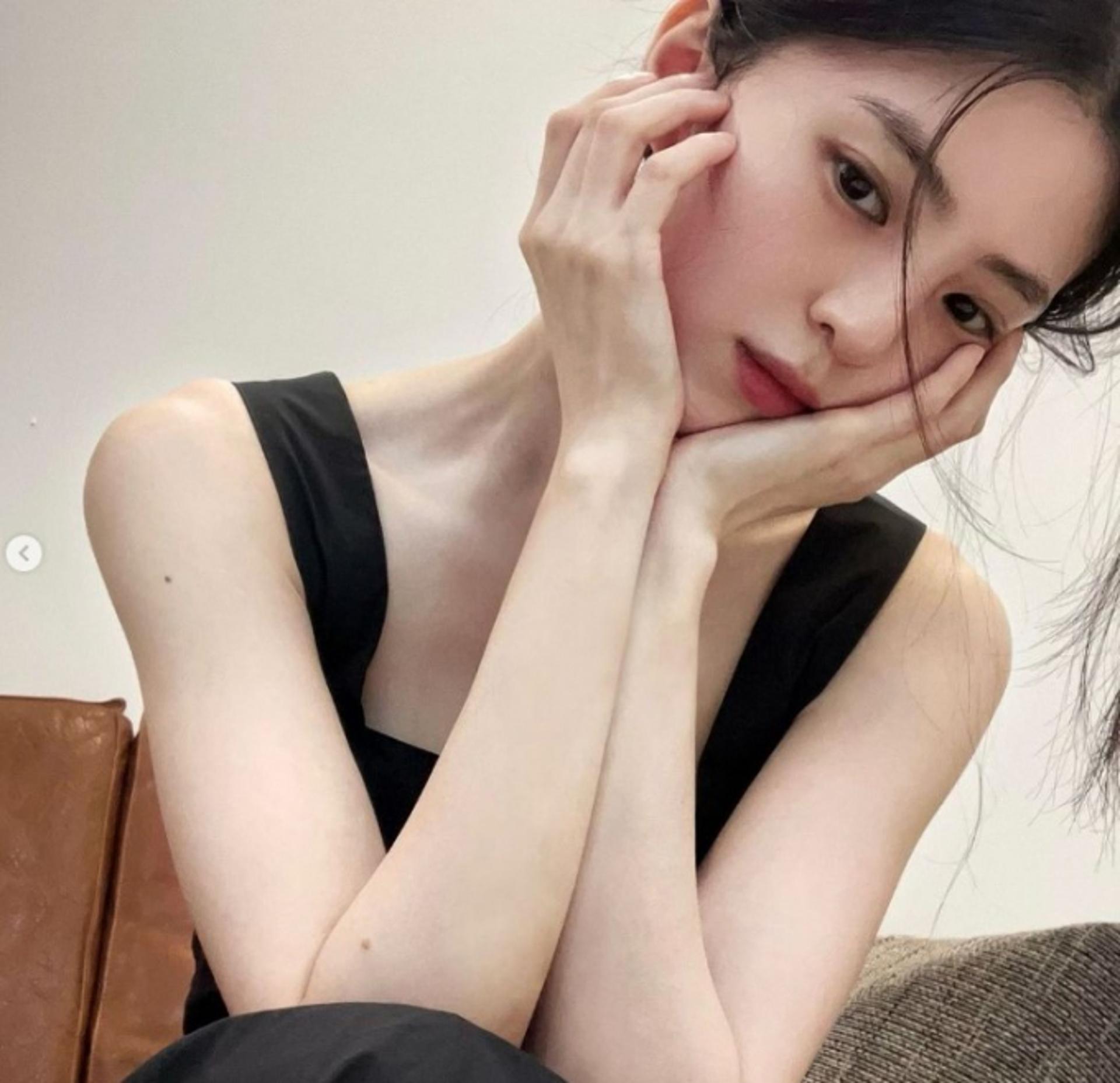 '안면 부상' 한소희 근황… 더 야위었네?
