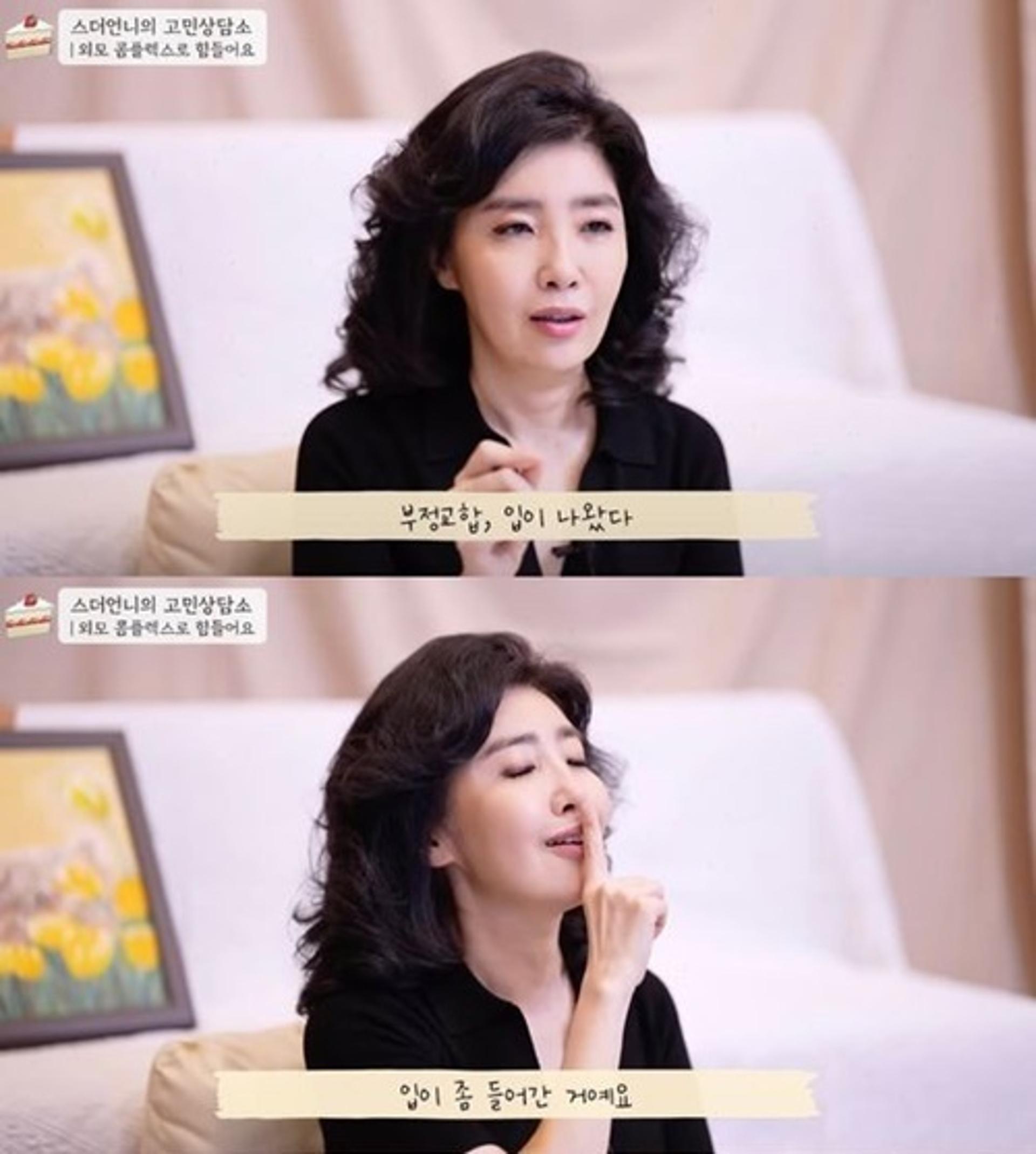 '홍혜걸♥' 여에스더, 성형 의혹 해명 나선 이유