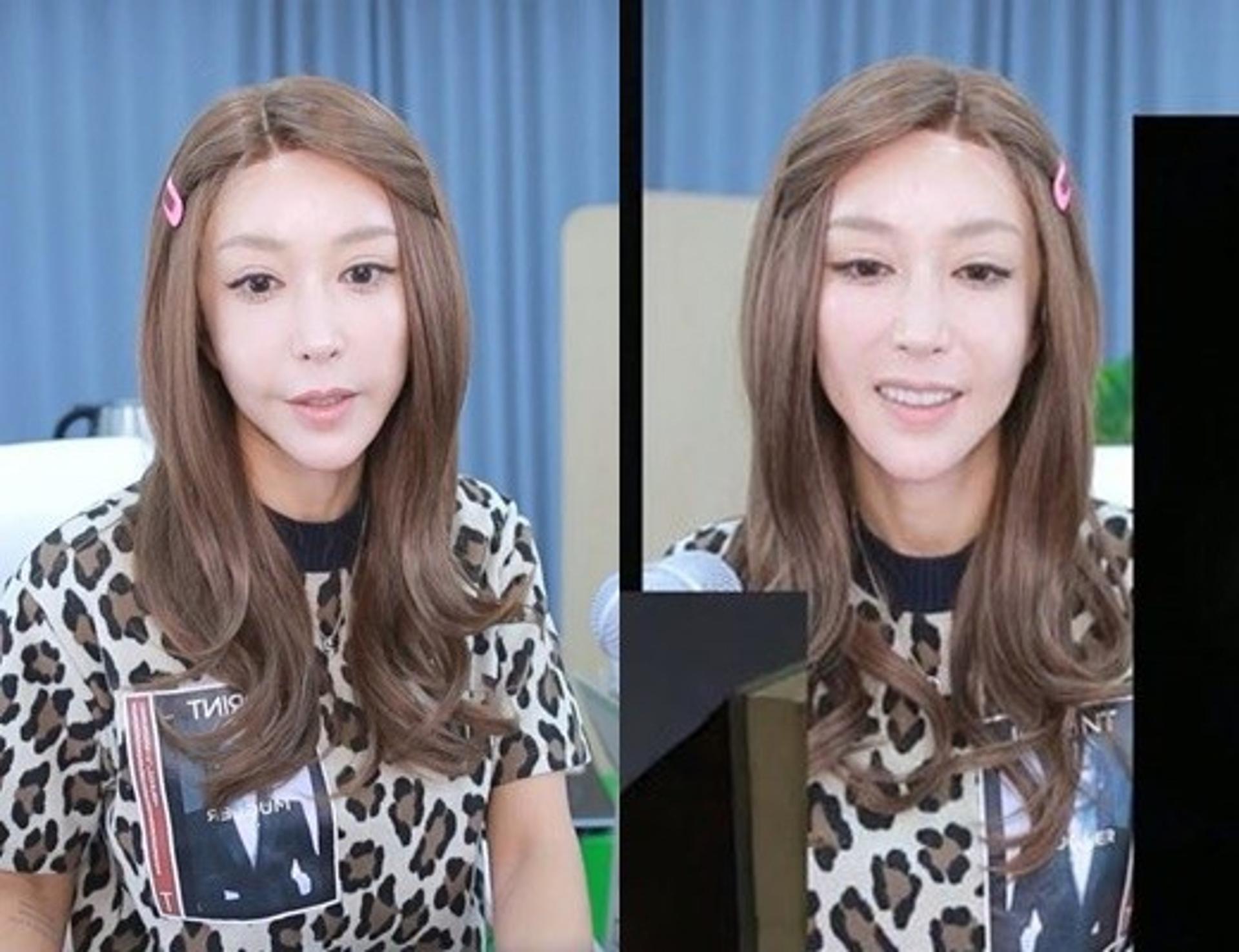 묘하게 달라진 얼굴?… '도박 물의' 슈 근황 '화제'