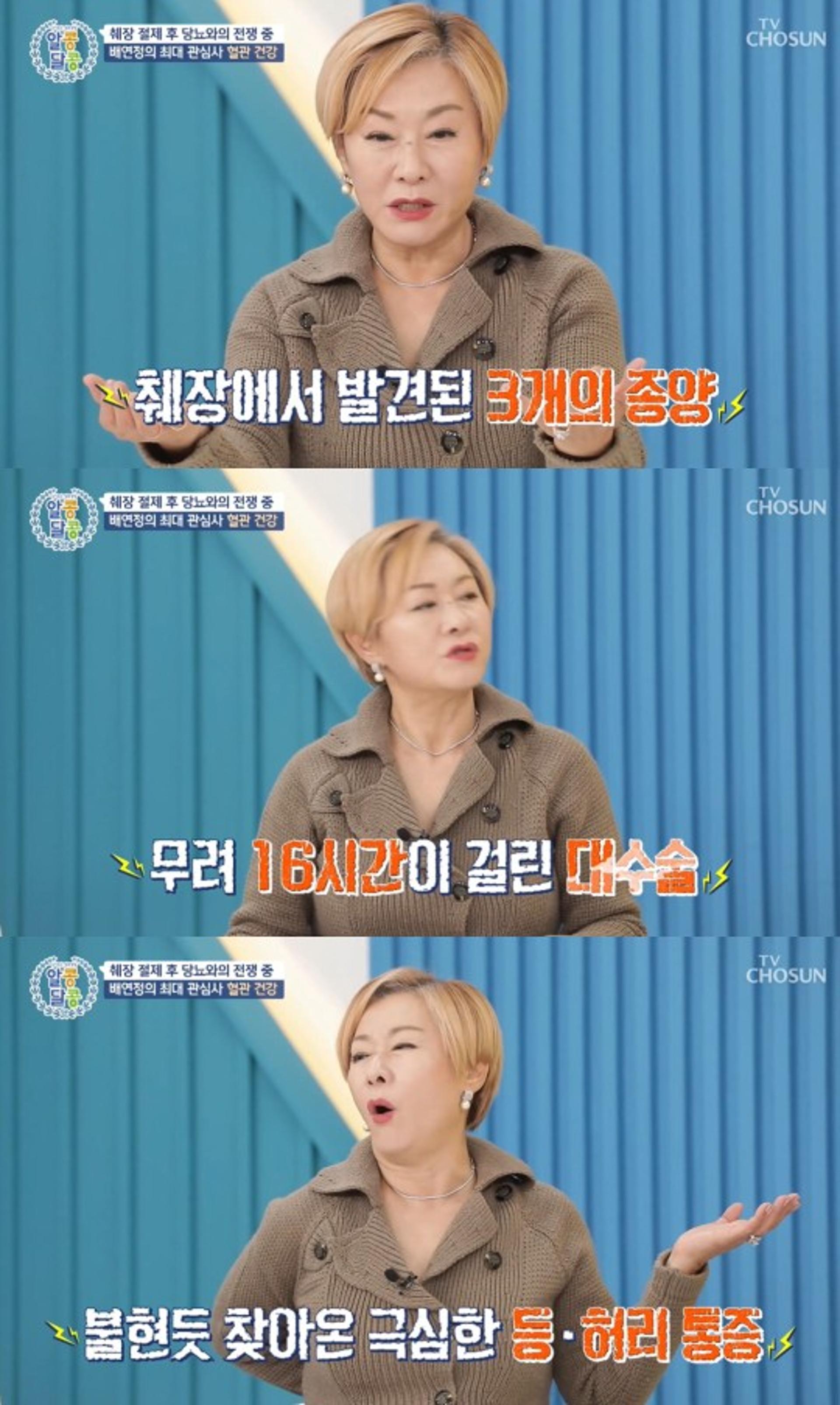 "췌장에 종양만 3개"… 배연정, 16시간 수술 받았다?