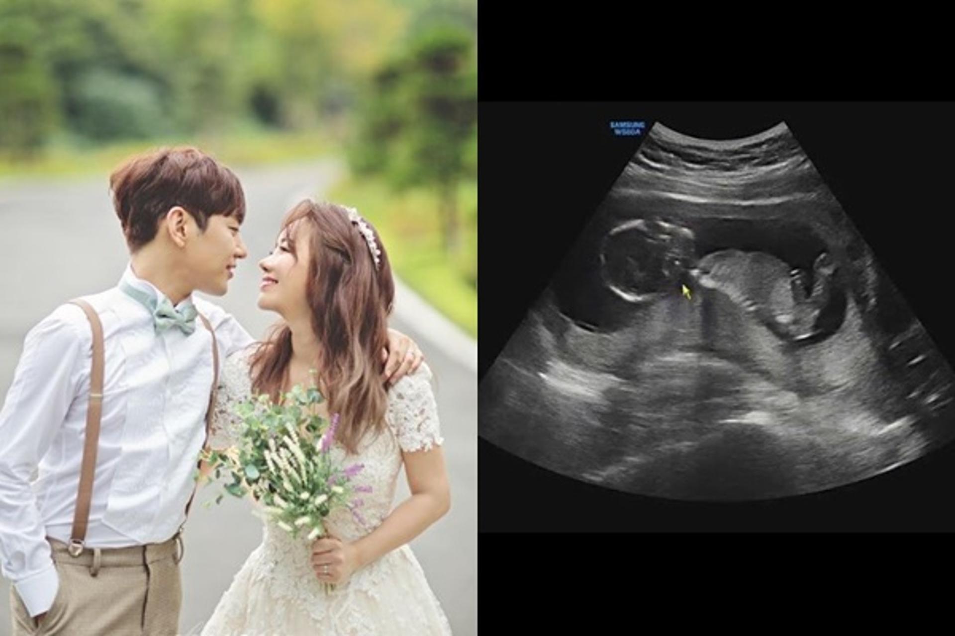 "5월에 만나자"… 안용준♥베니 부모된다, 결혼 8년 만 임신