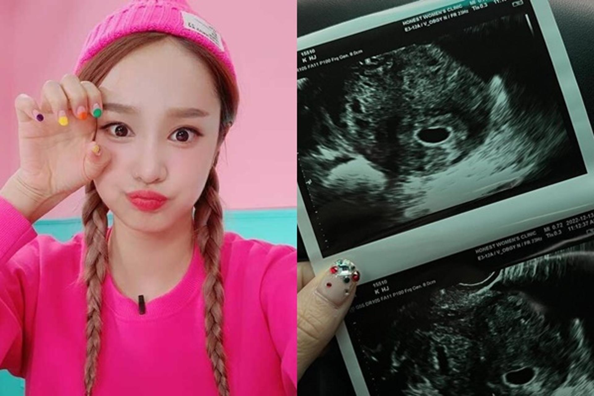 '351만 유튜버' 헤이지니, 결혼 5년 만 임신 … "토끼띠 맘 된다"