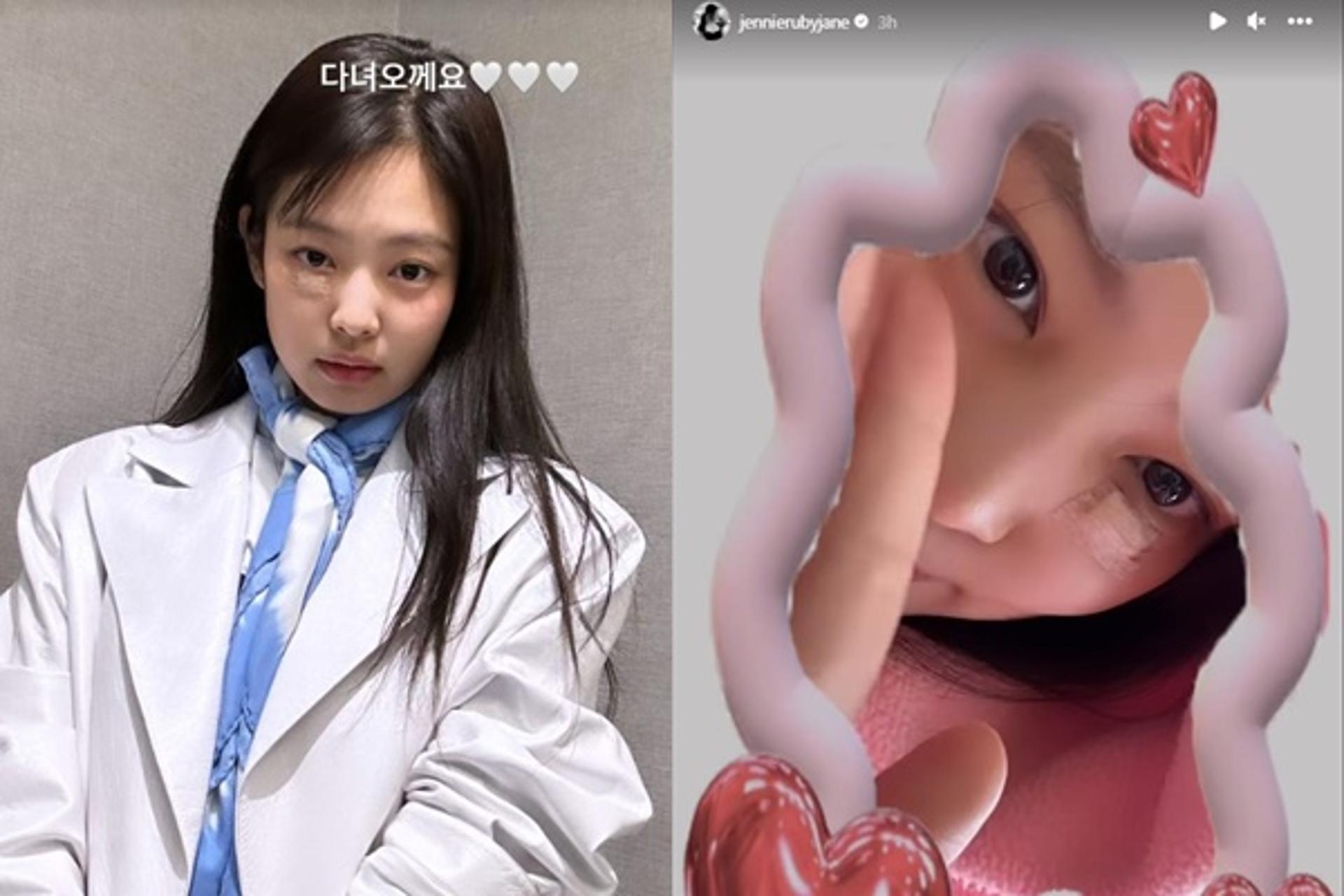 제니, 부상 어느정도길래?… 눈 밑 반창고 "안쓰러워"