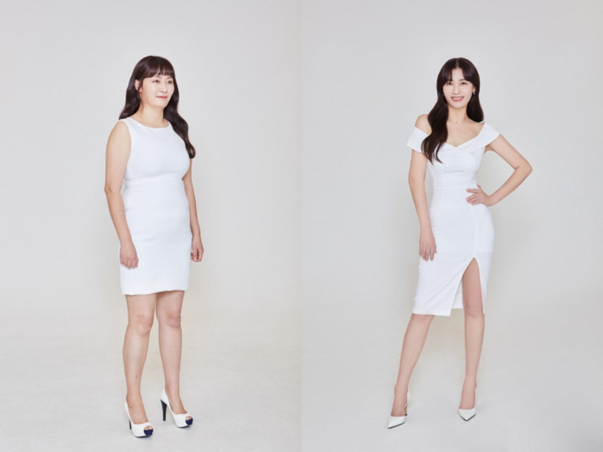 다이어트 감량 비결은?… 김미려, 11㎏ 감량했다더니 '대박'