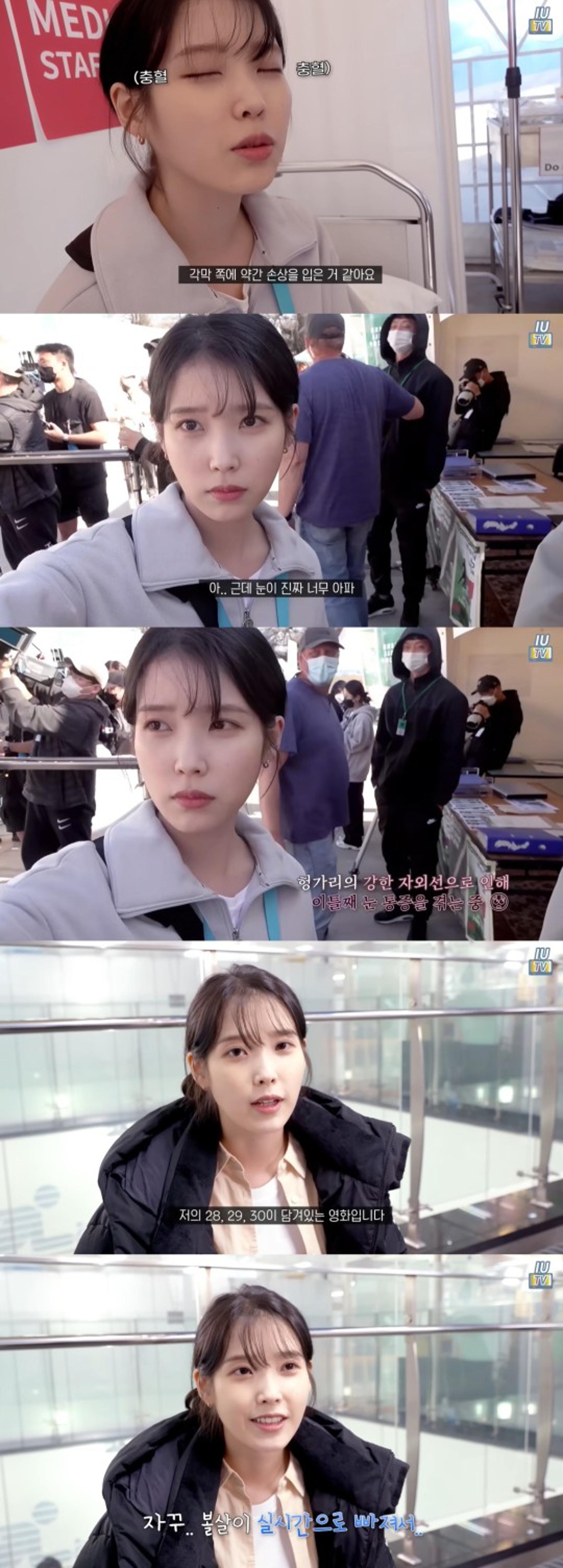 아이유 "각막 손상 입은 것 같아"… '드림' 촬영 중 무슨 일?