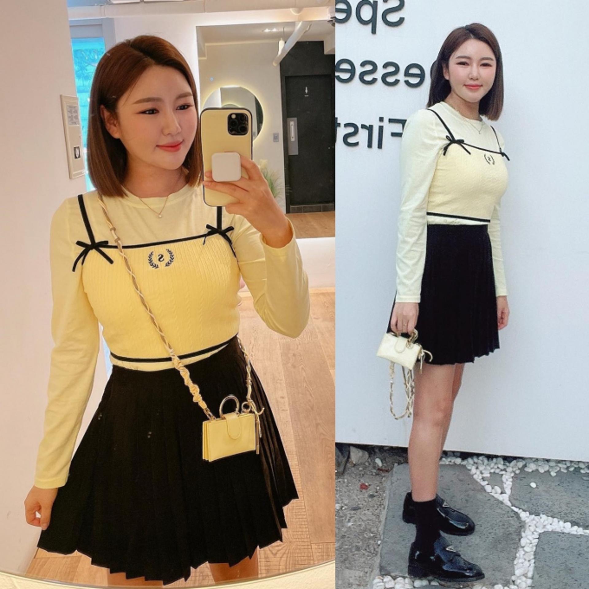 송가인, 화사한 연노랑 옷 입으니 더 어려보이네